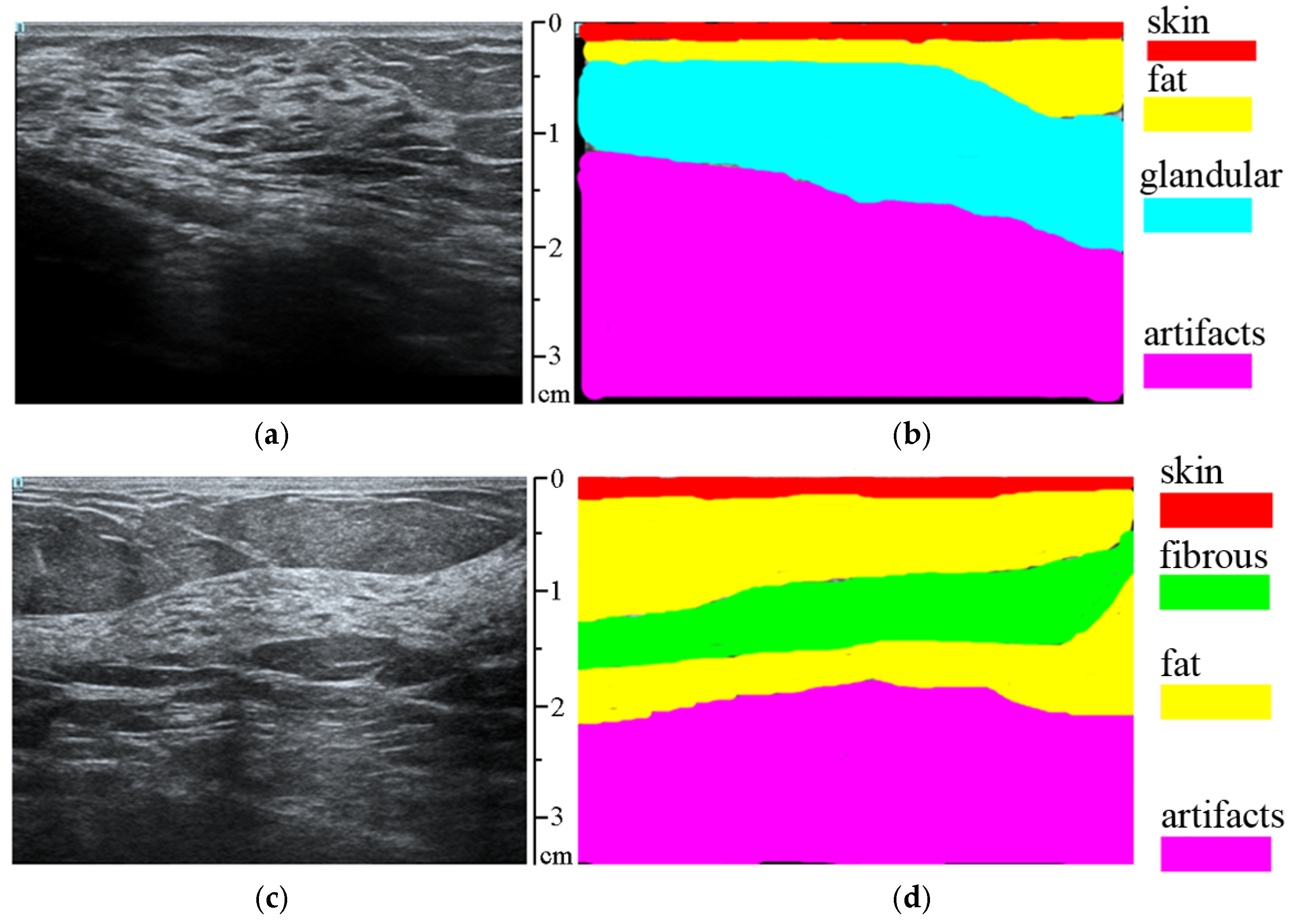 Sensors 25 01593 g003
