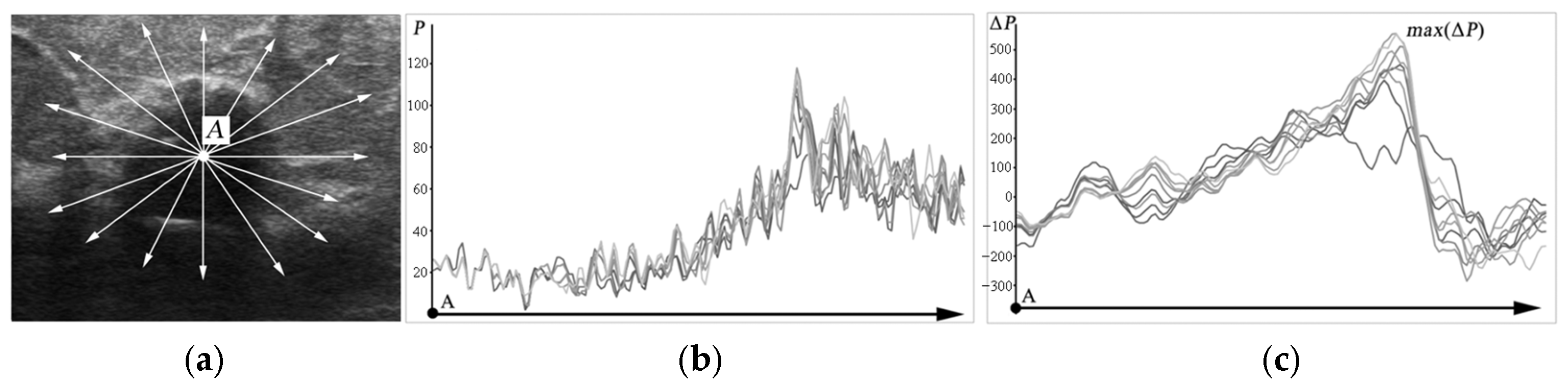Sensors 25 01593 g005