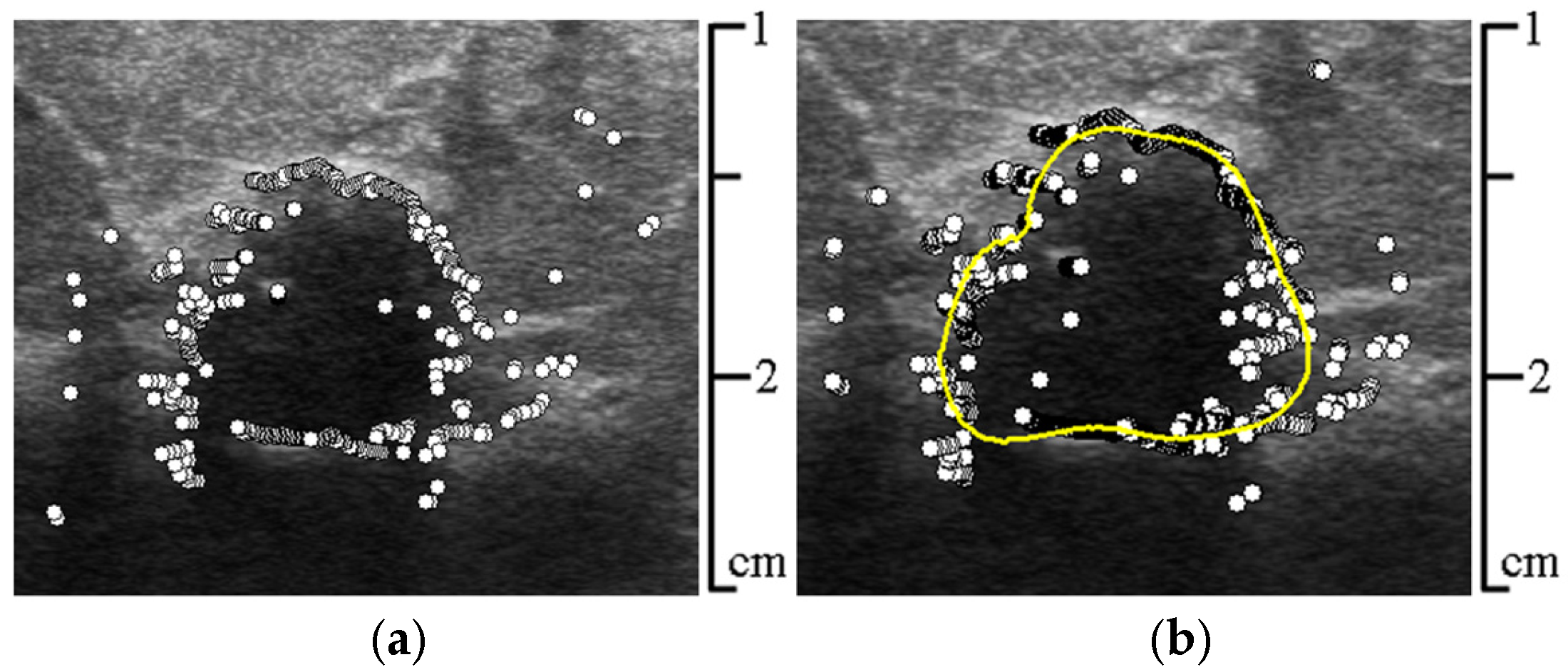 Sensors 25 01593 g006