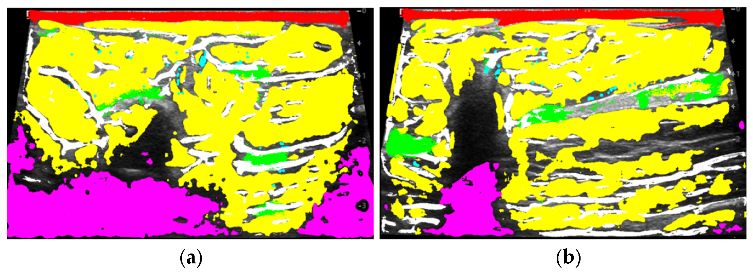 Sensors 25 01593 g007a