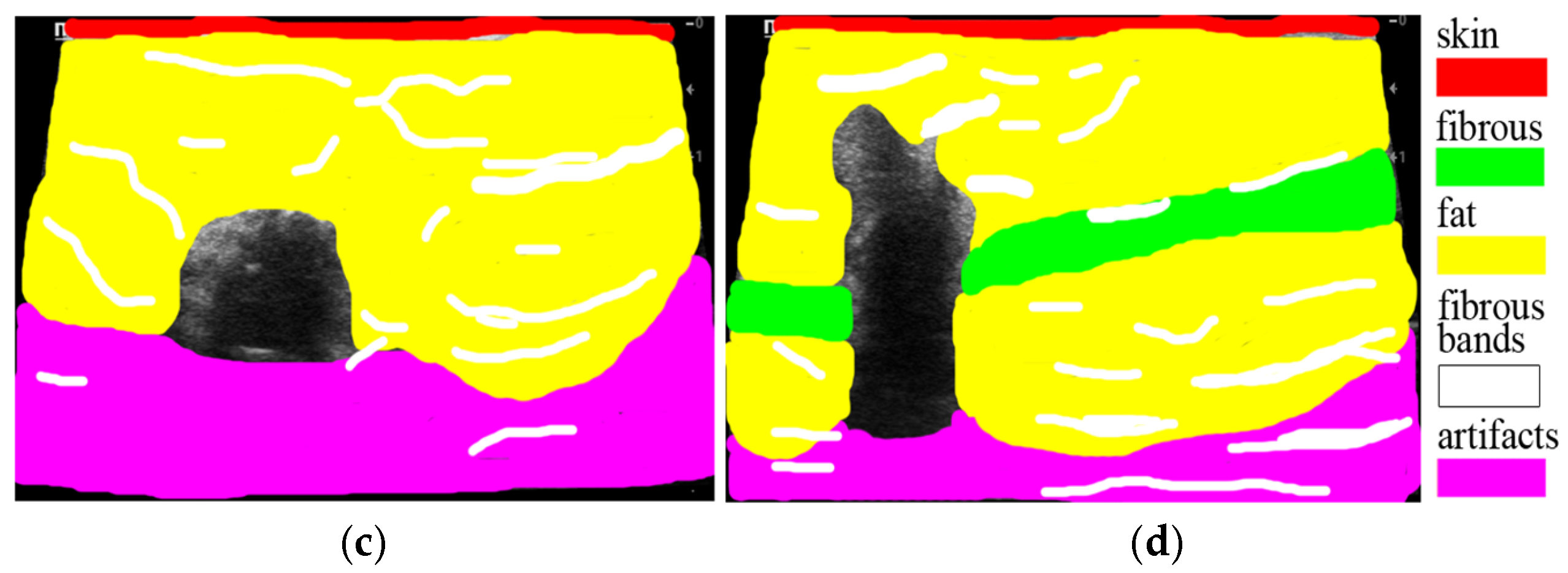 Sensors 25 01593 g007b