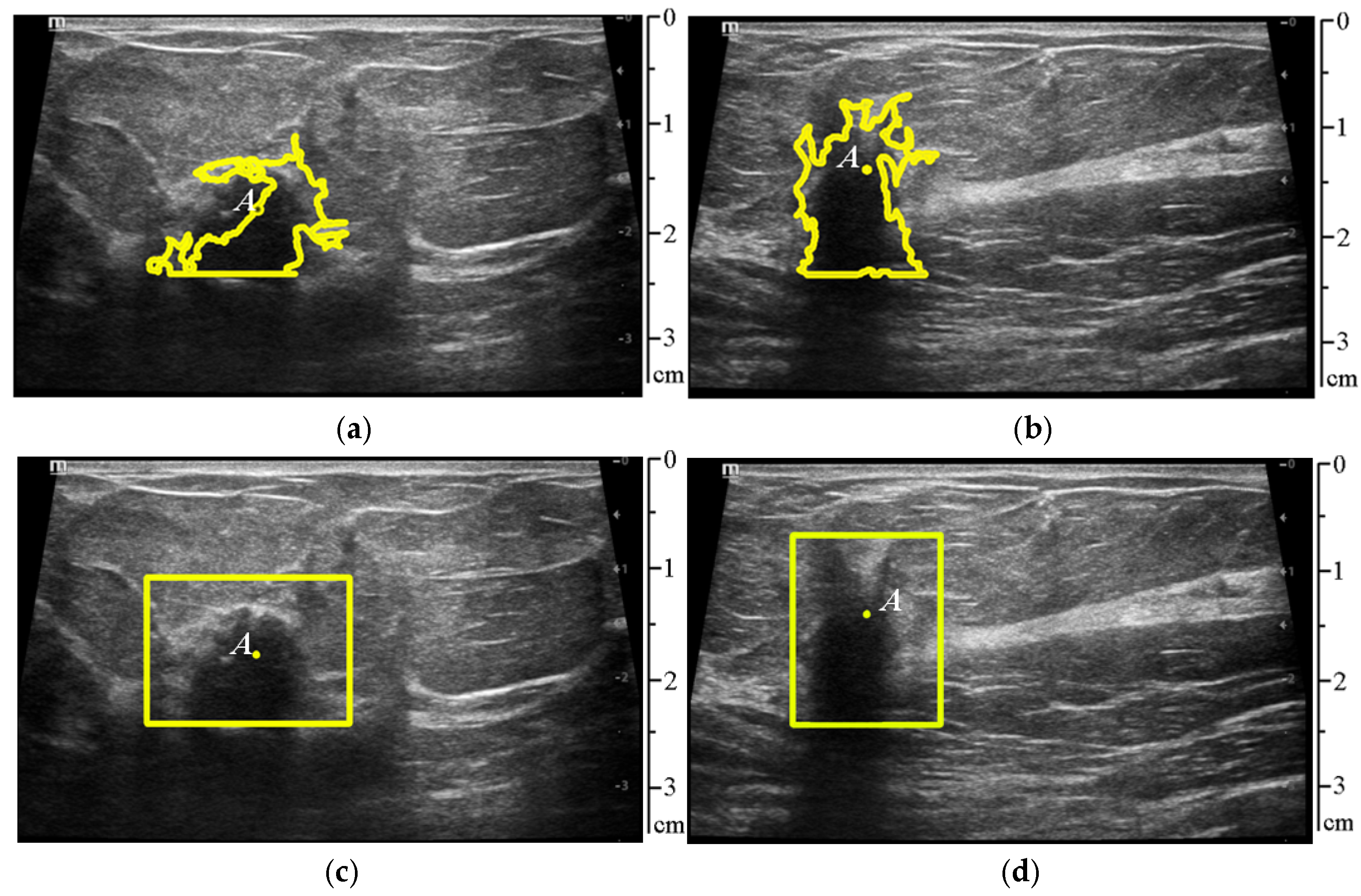 Sensors 25 01593 g008