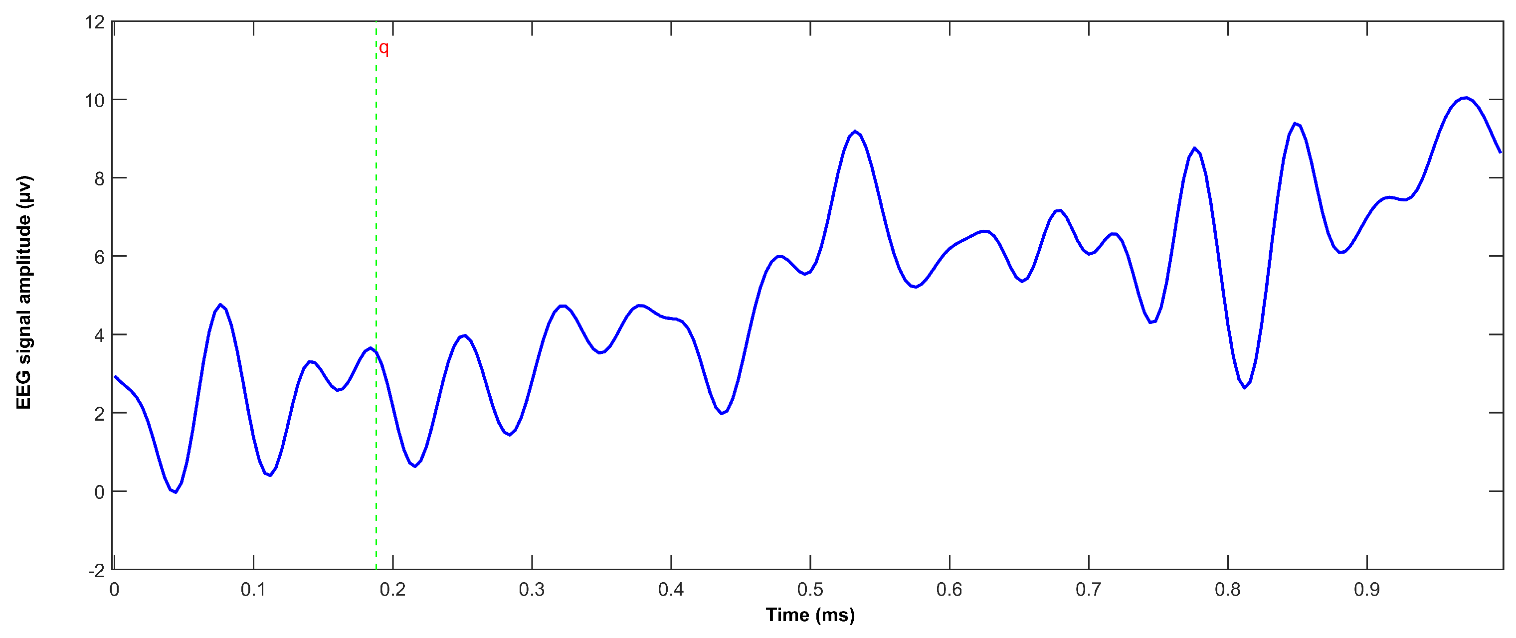 Sensors 25 01802 g008