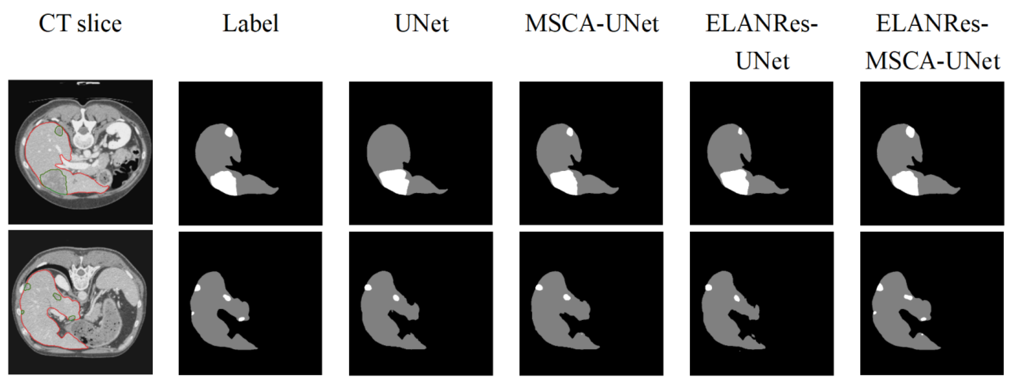 Sensors 25 01814 g005