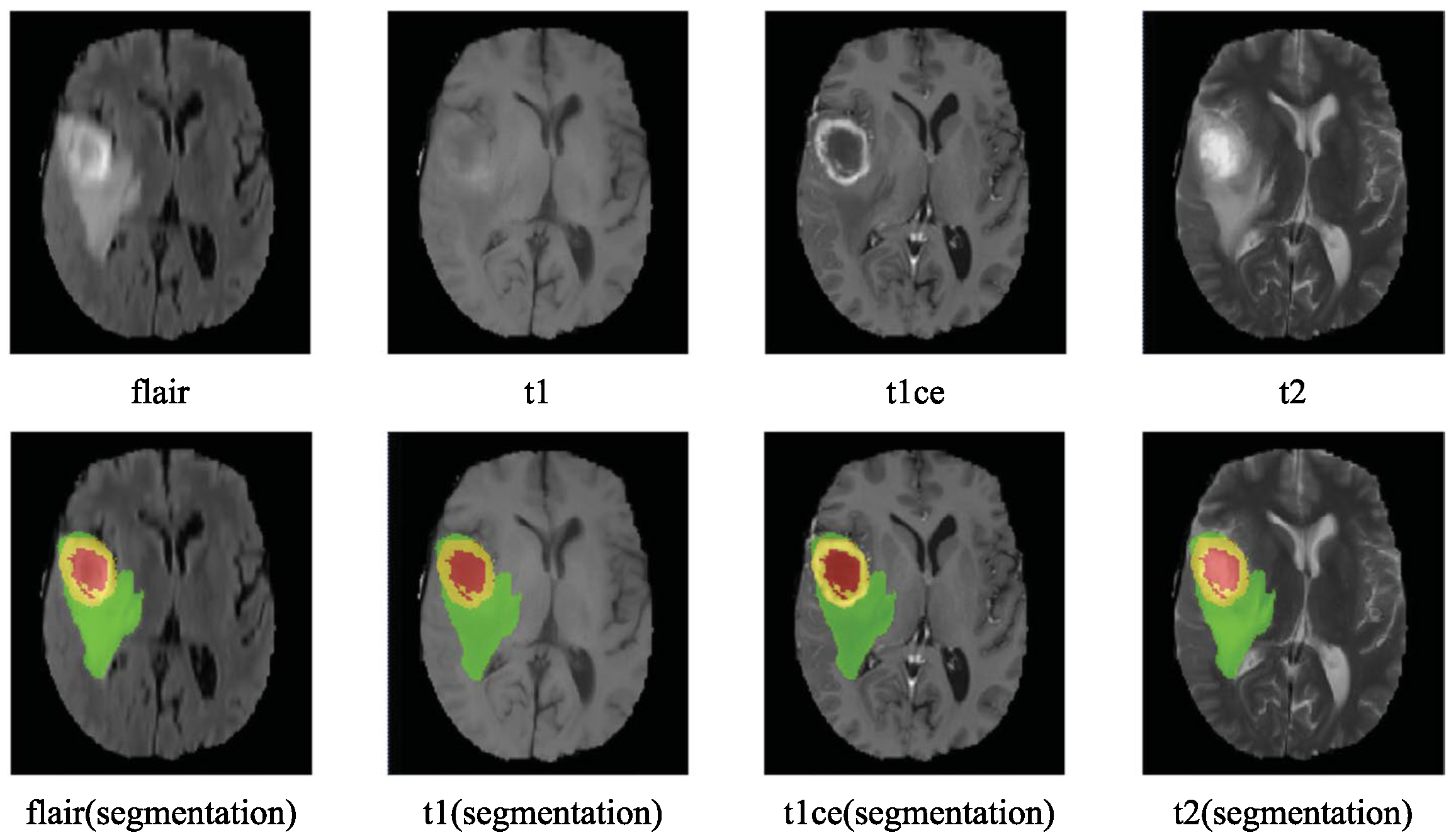 Sensors 25 01838 g002