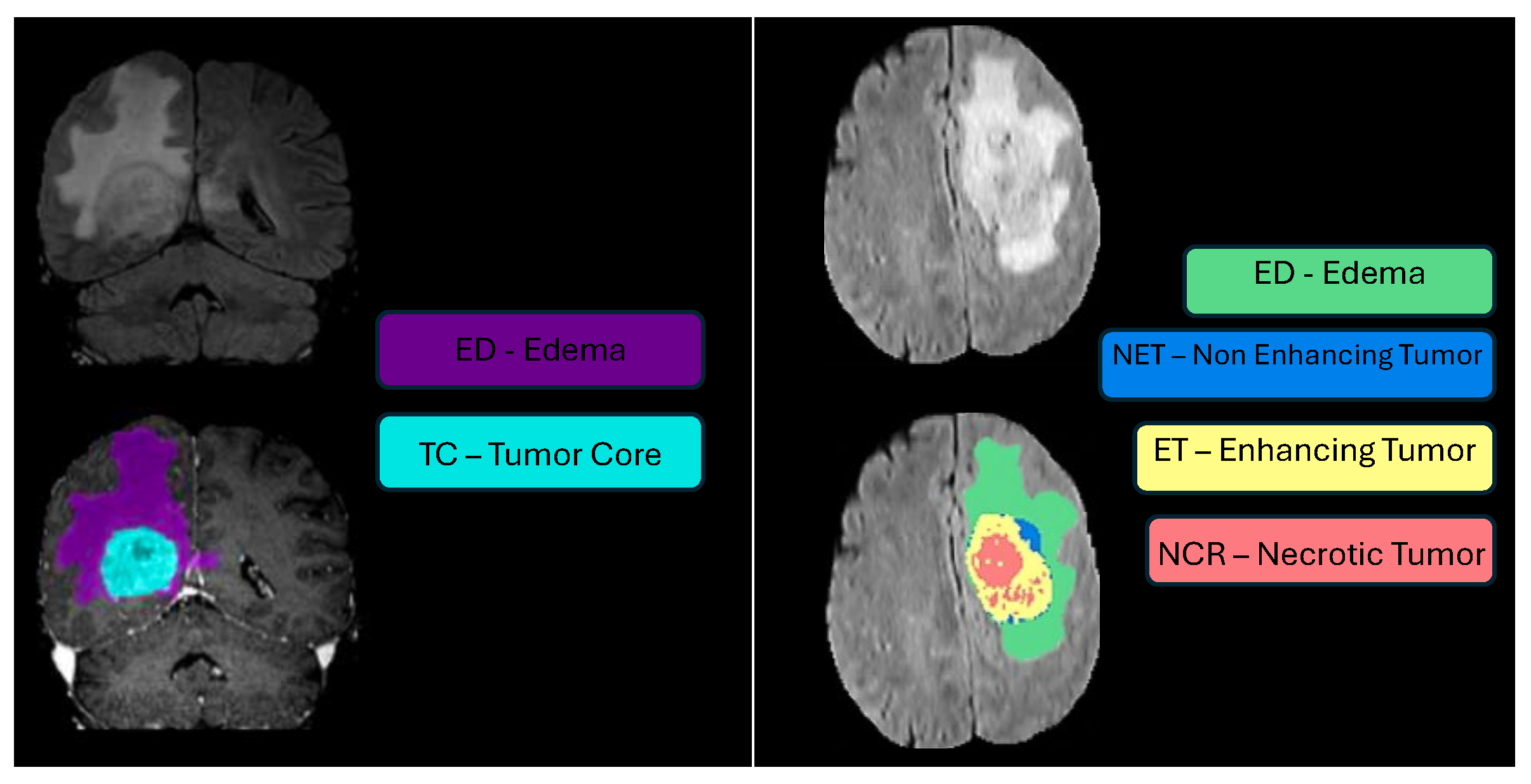 Sensors 25 01838 g003