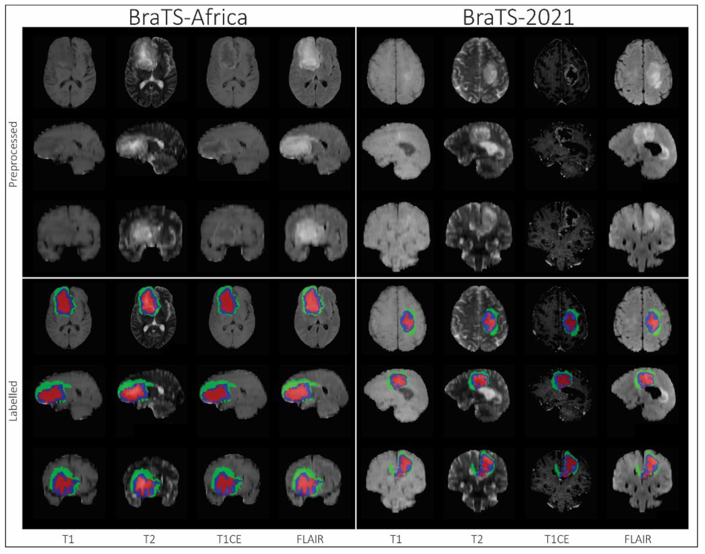 Sensors 25 01838 g006