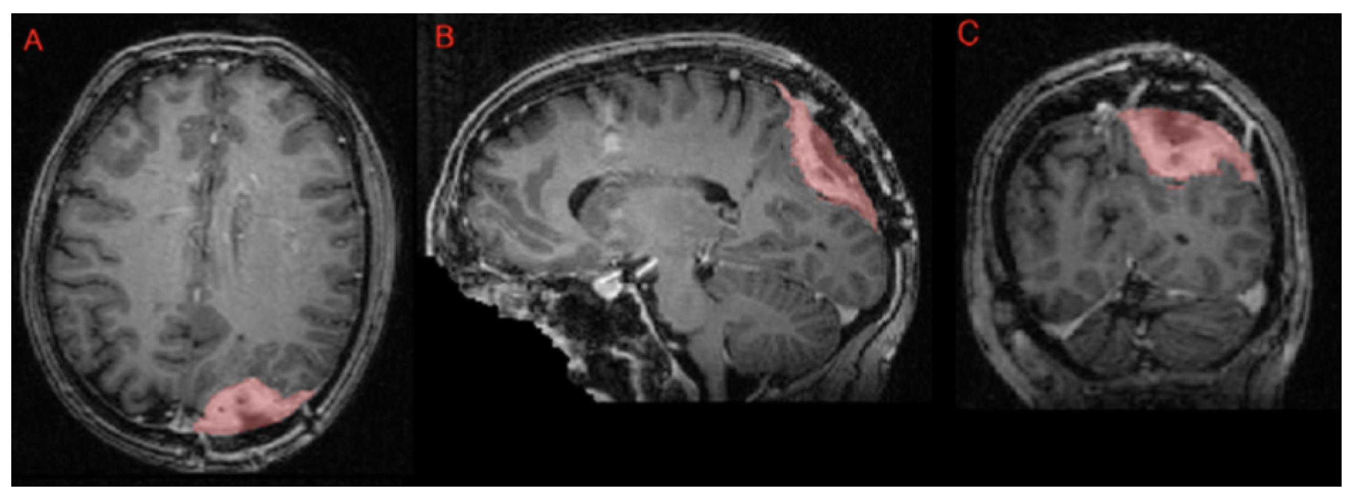 Sensors 25 01838 g012