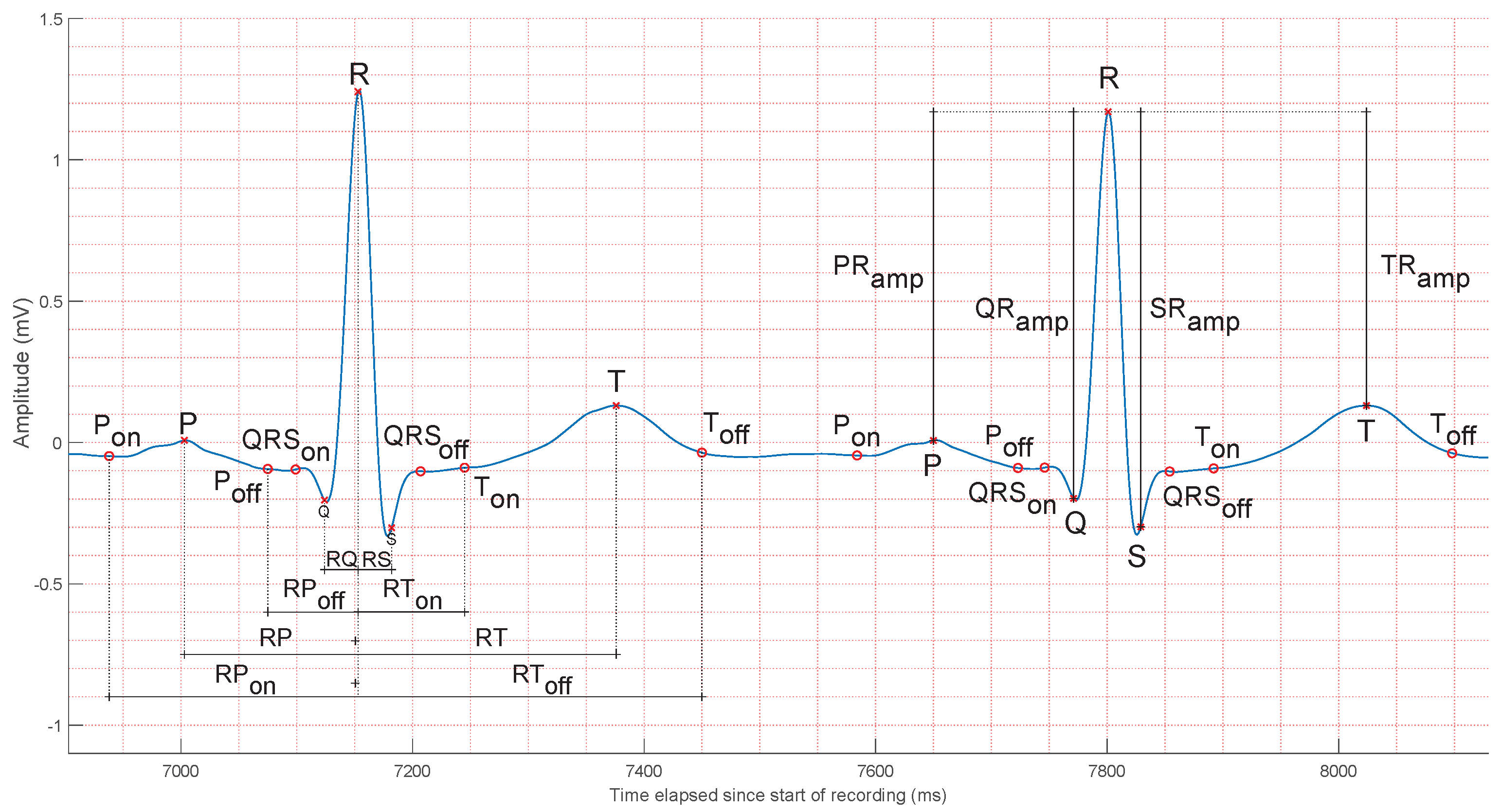 Sensors 25 01864 g002