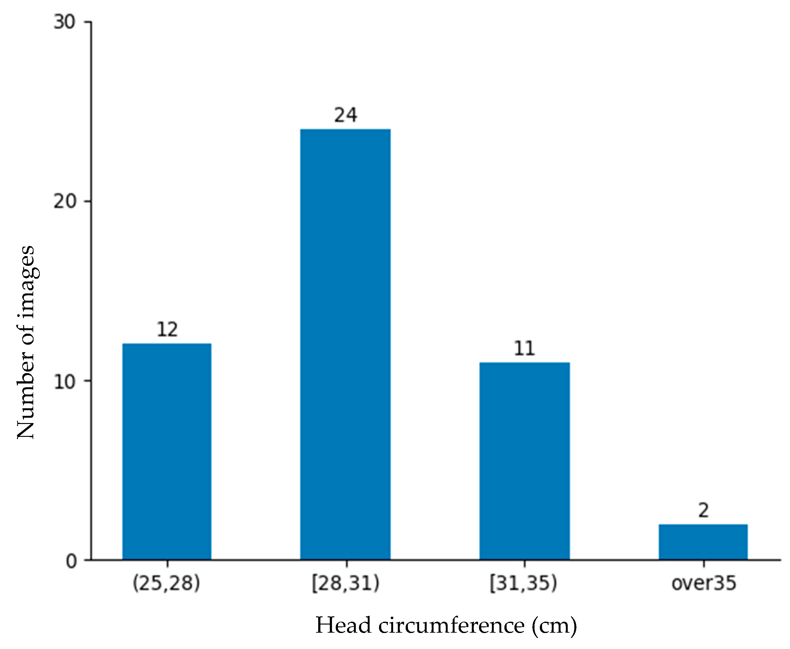 Sensors 25 01869 g011