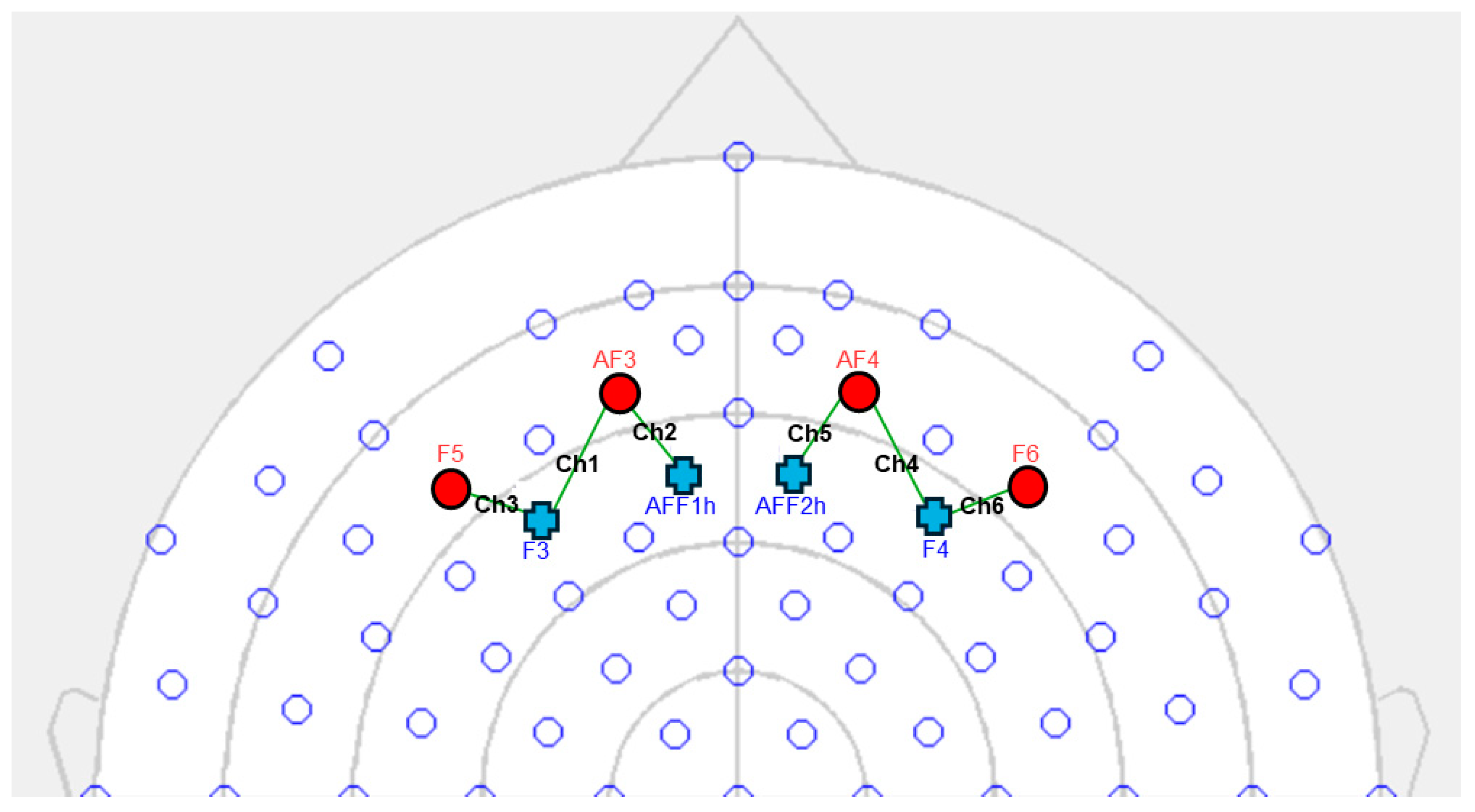 Sensors 25 01880 g002 Sensors 25 01880 g002