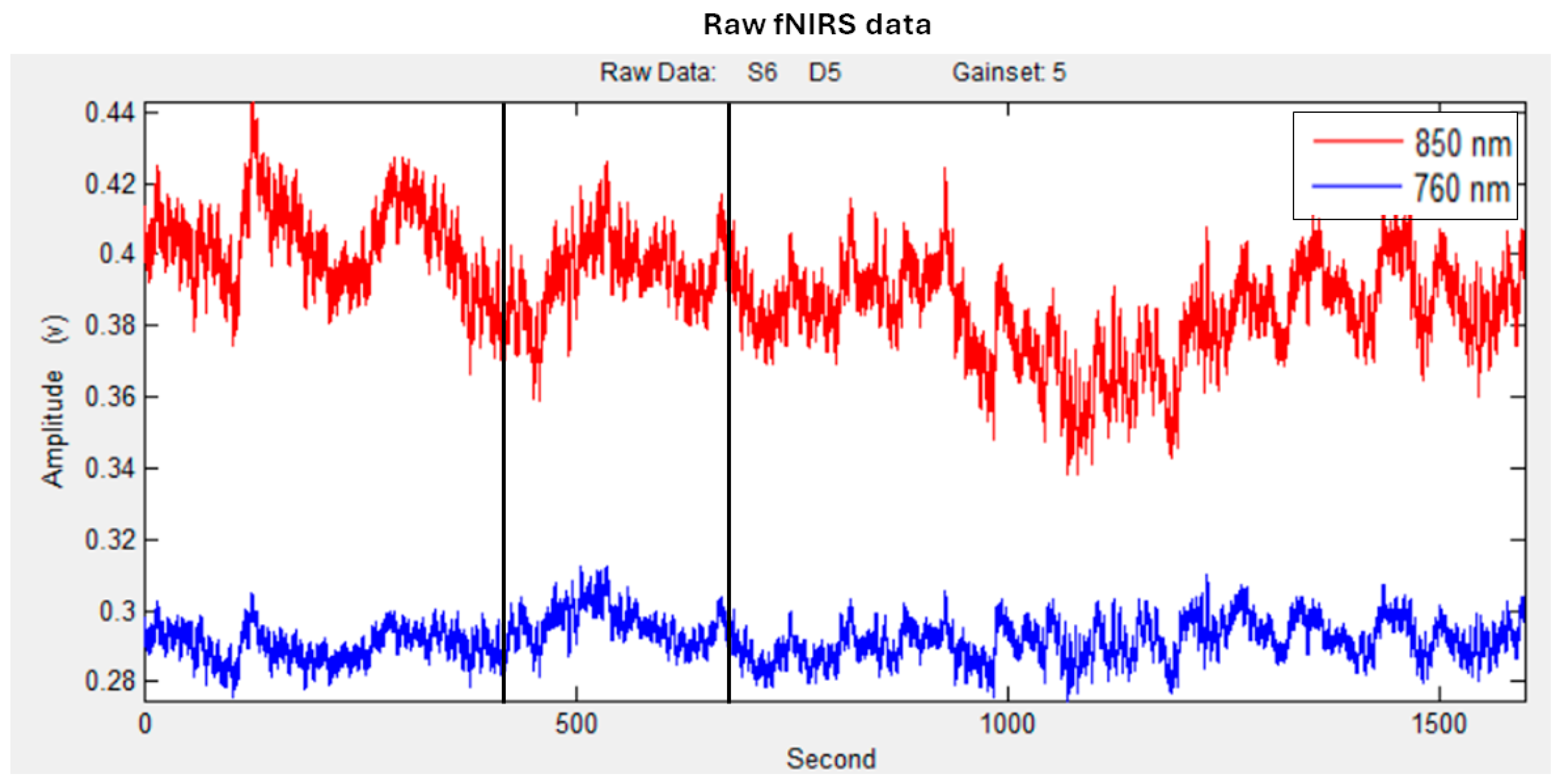 Sensors 25 01880 g003 Sensors 25 01880 g003