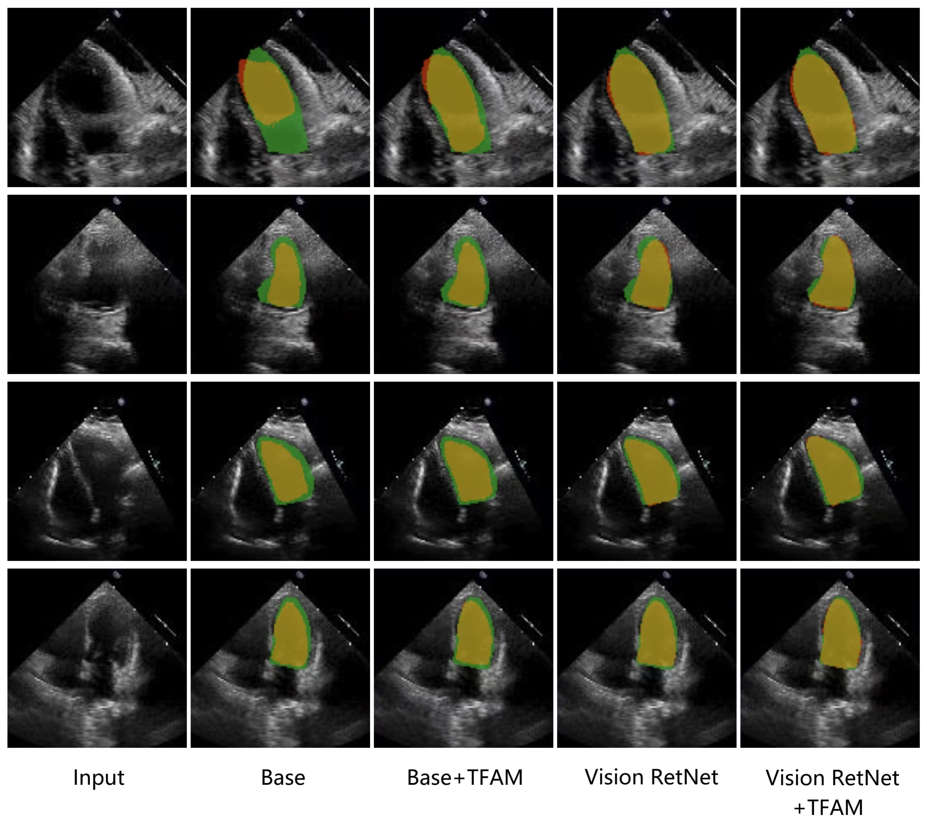 Sensors 25 01909 g008