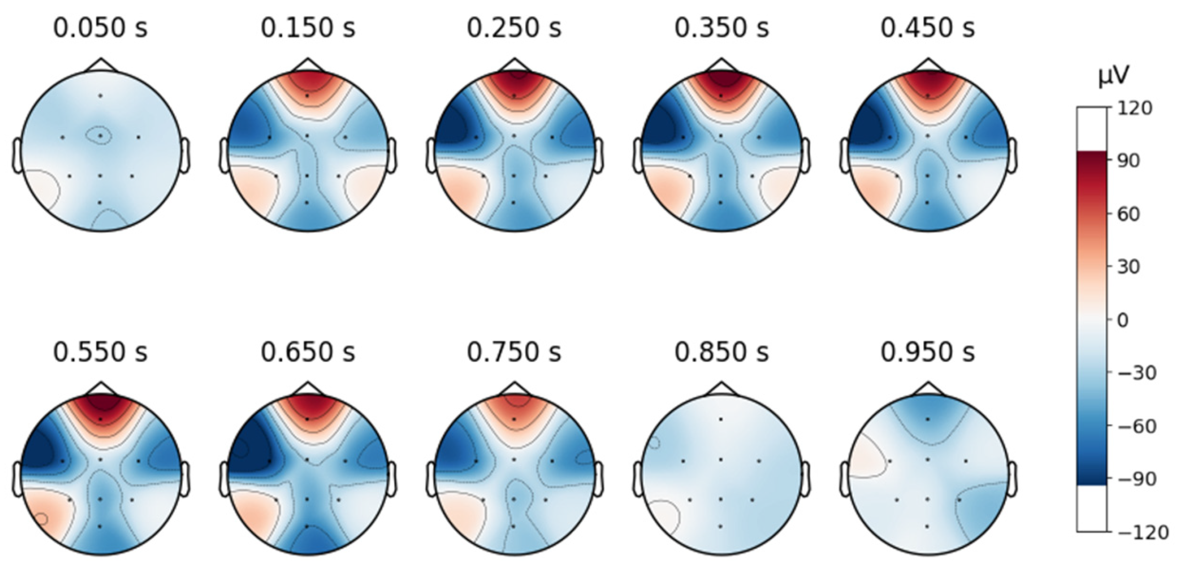 Sensors 25 02083 g005