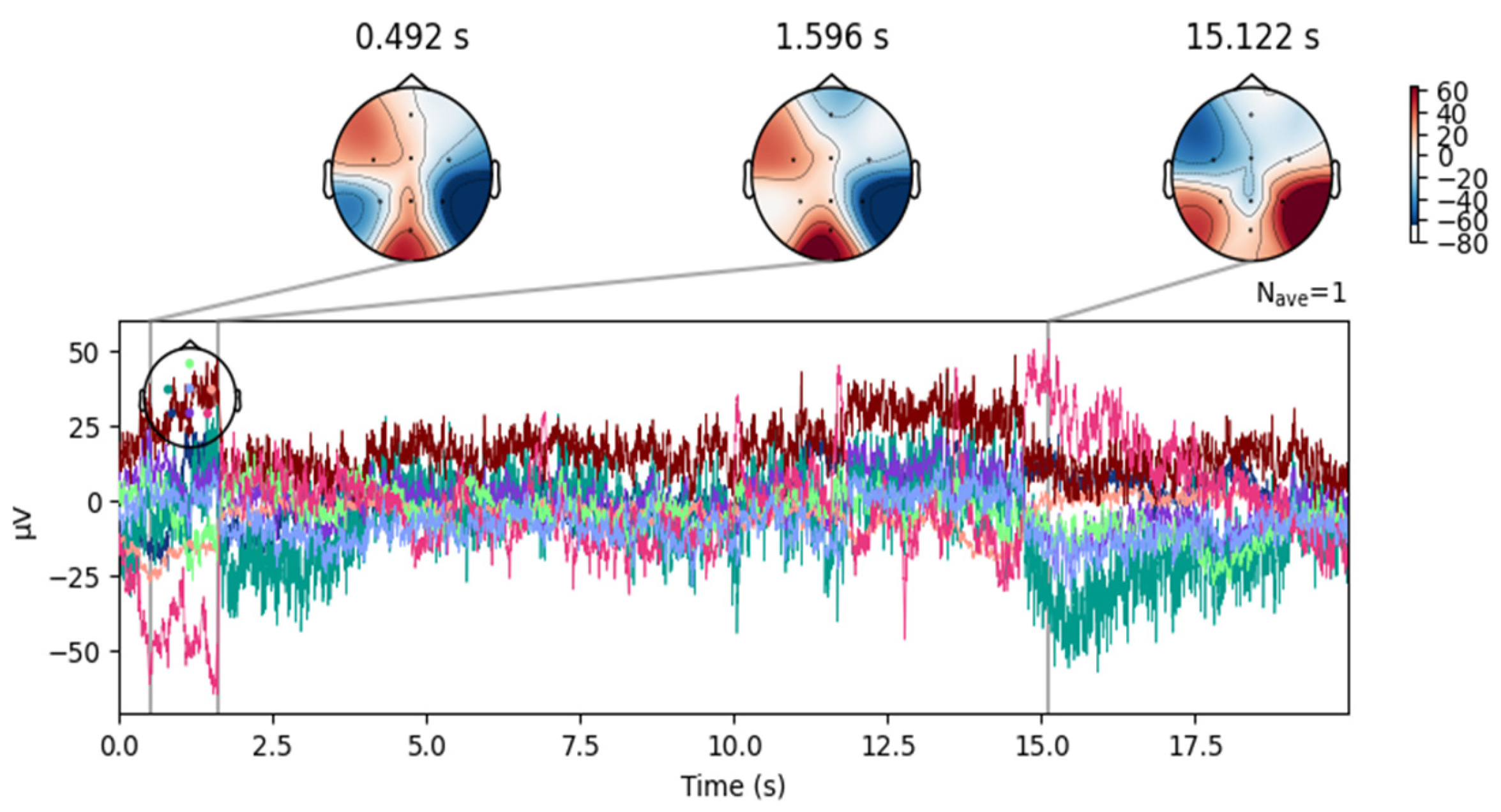 Sensors 25 02083 g007