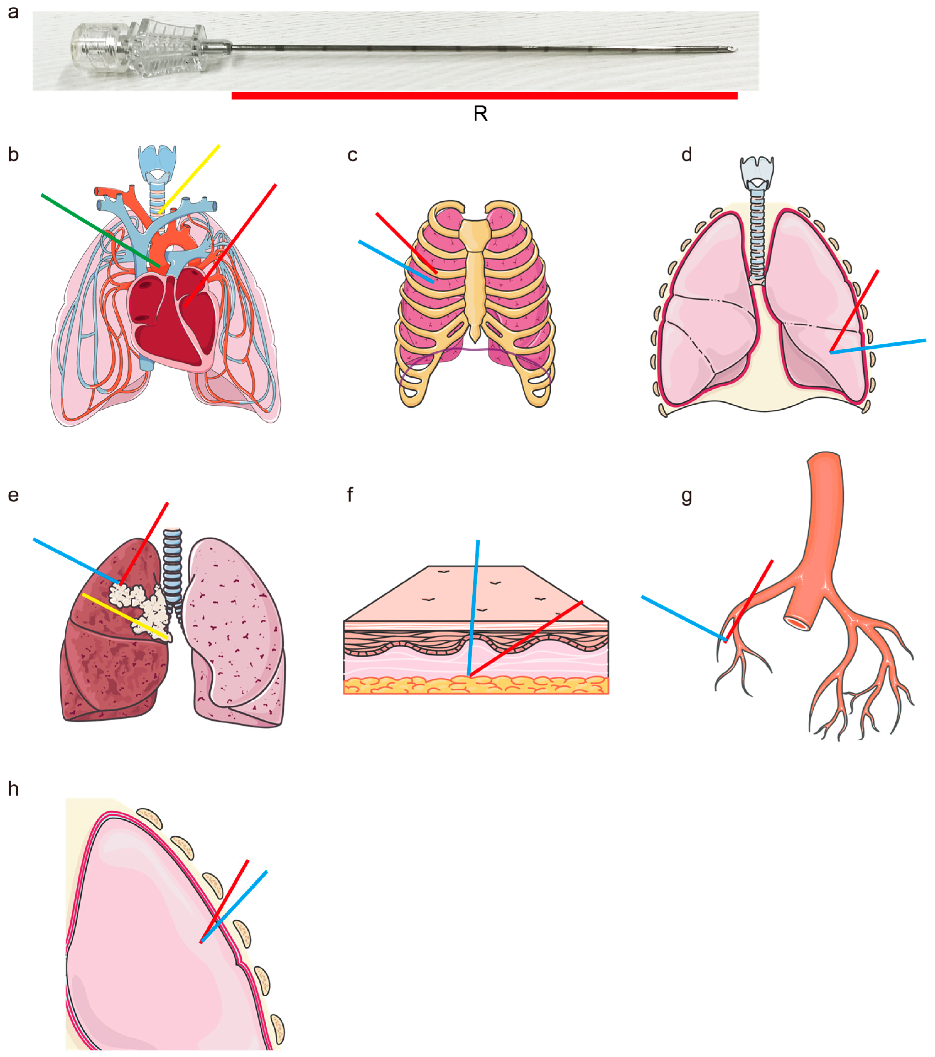 Sensors 25 02137 g001