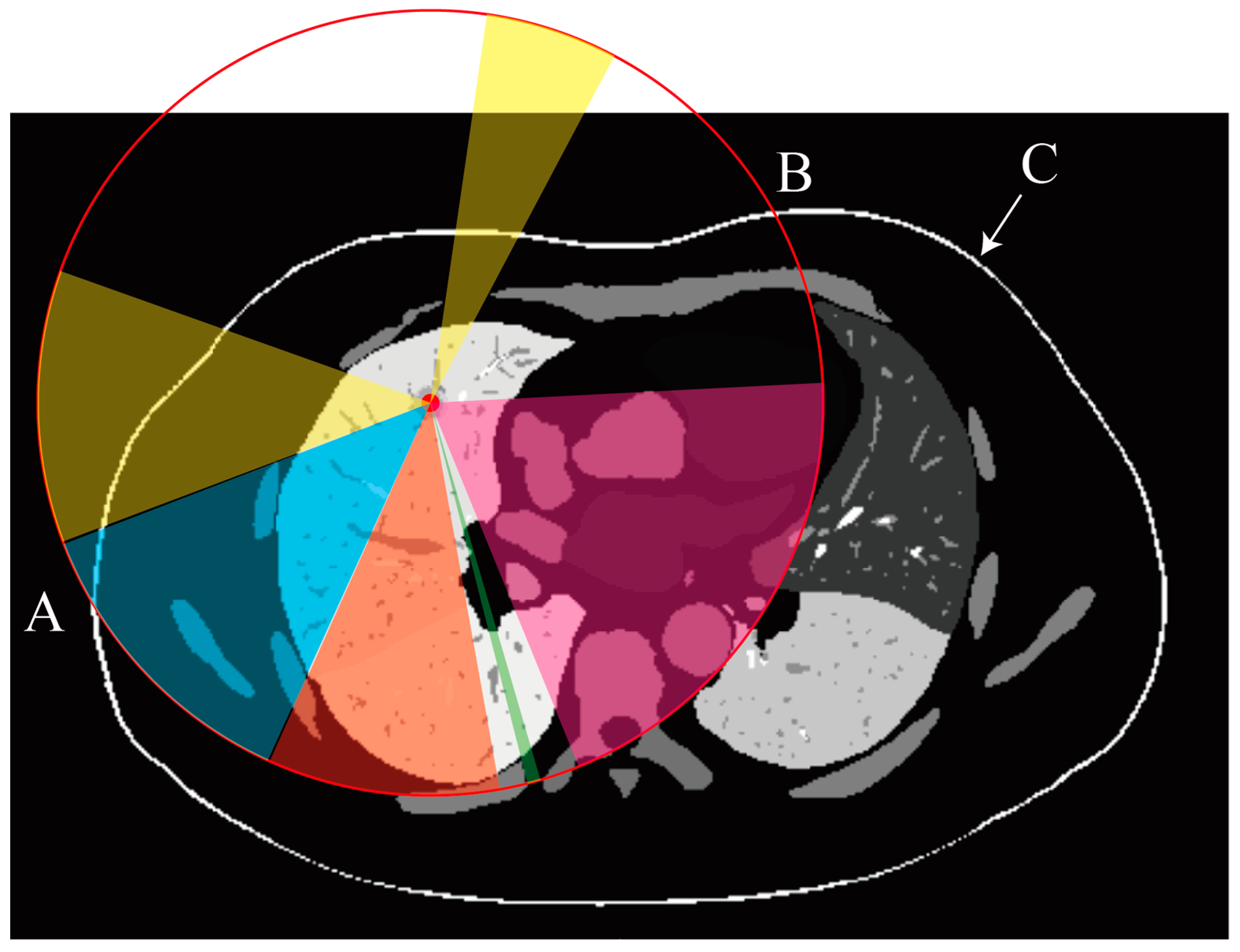 Rapid Path Planning Algorithm for Percutaneous Rigid Needle Biopsy ...