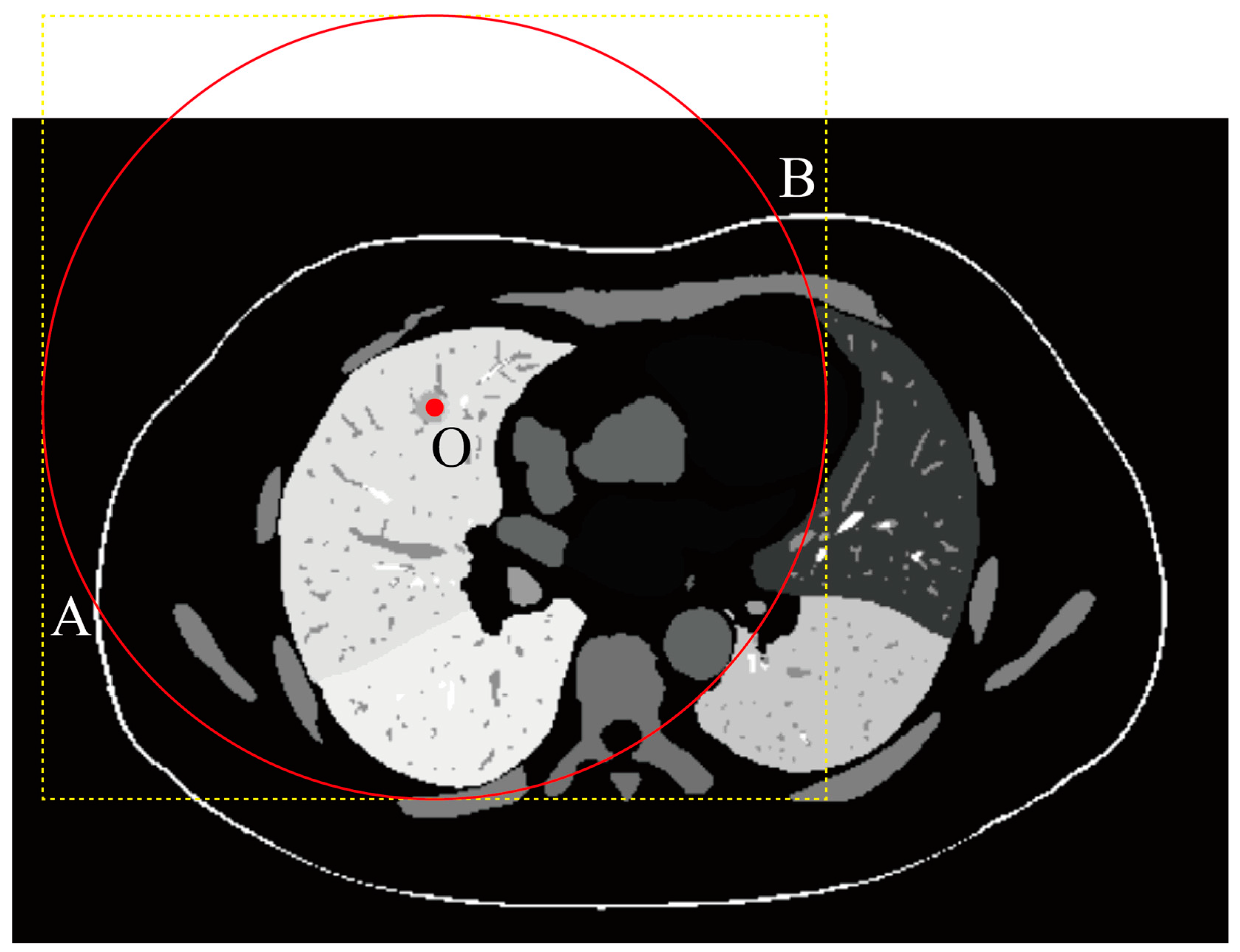Rapid Path Planning Algorithm for Percutaneous Rigid Needle Biopsy ...