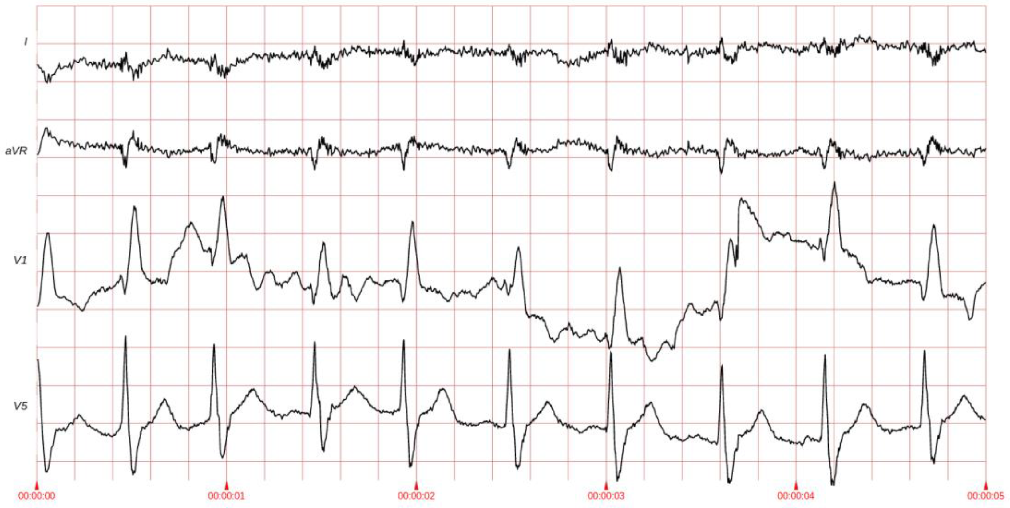 Sensors 25 02185 g002
