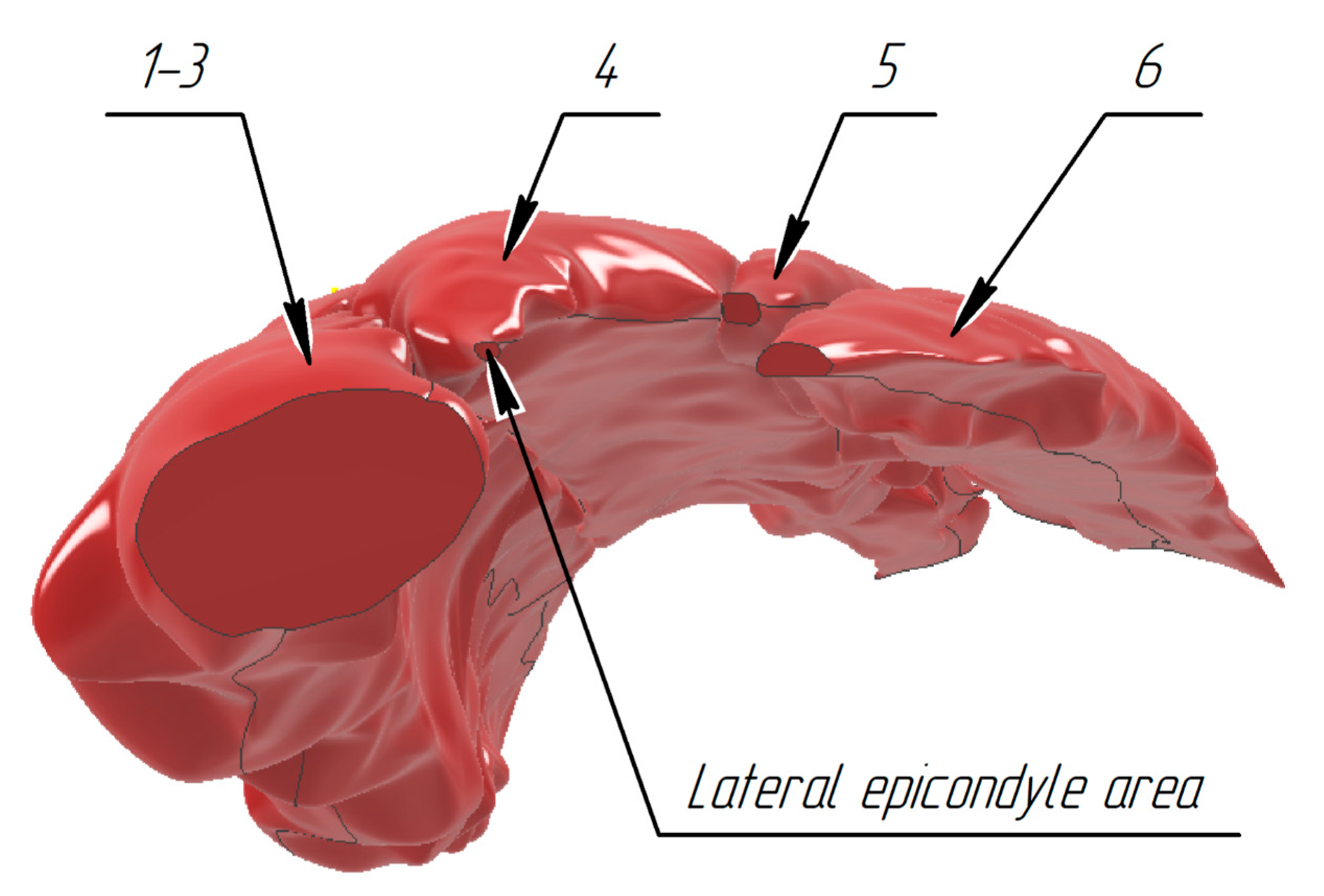 Sensors 25 02298 g014