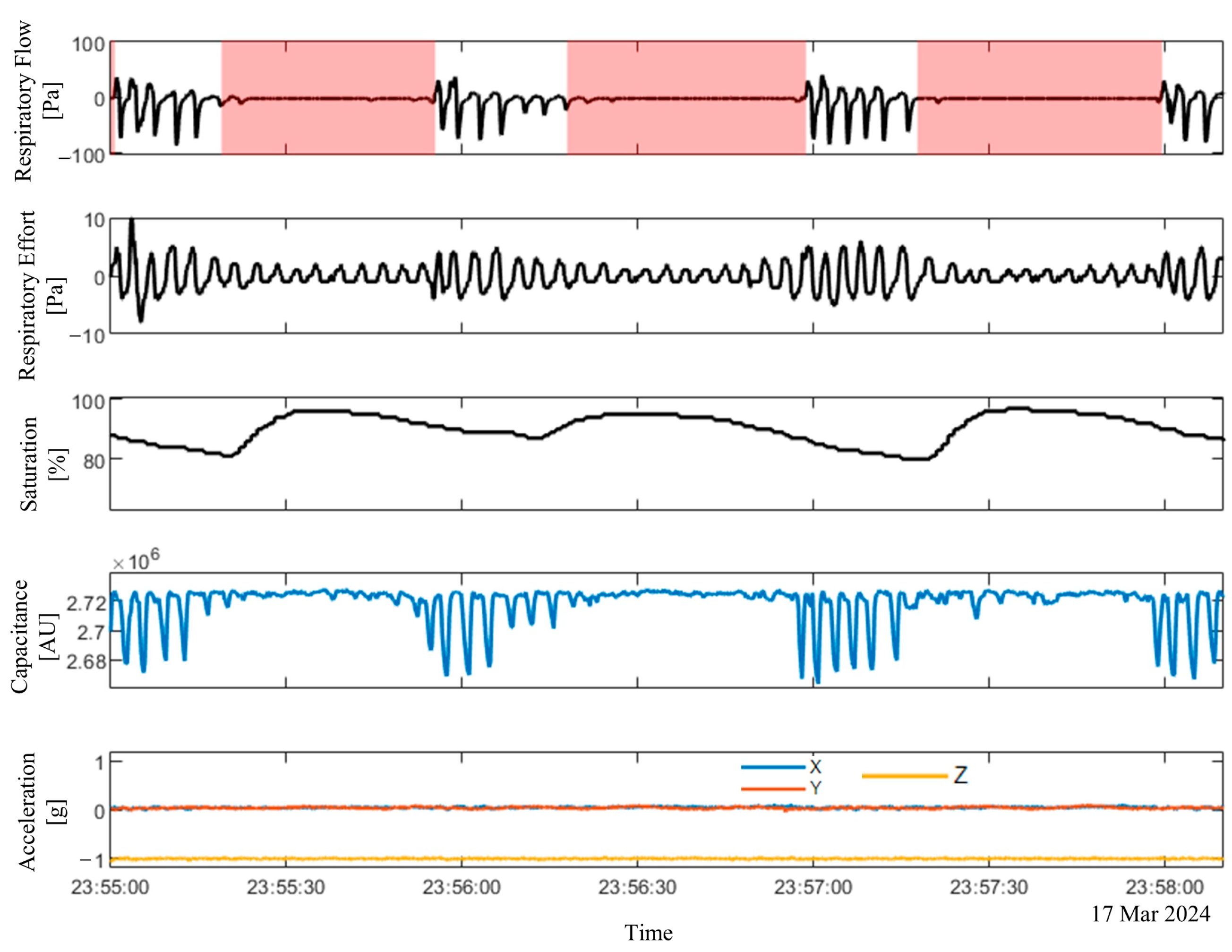 Sensors 25 02412 g004