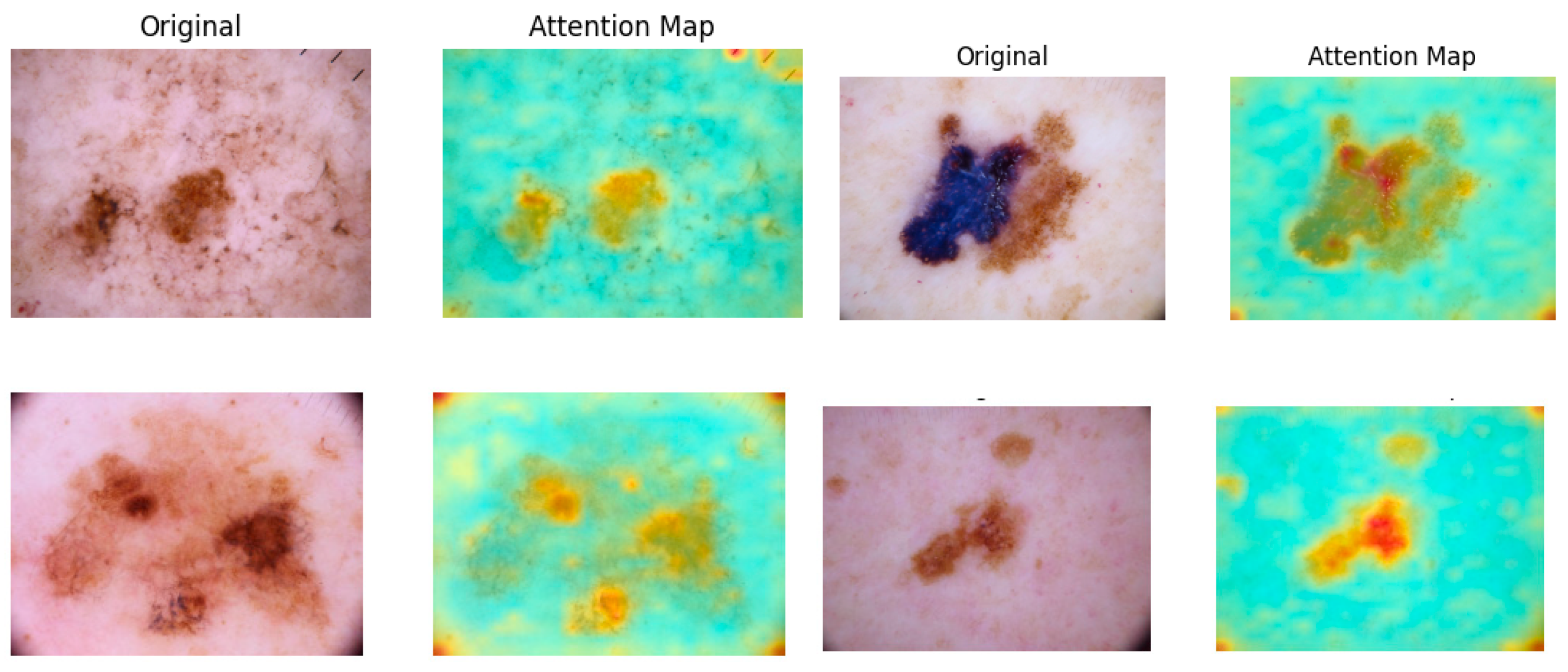 Sensors 25 02479 g004