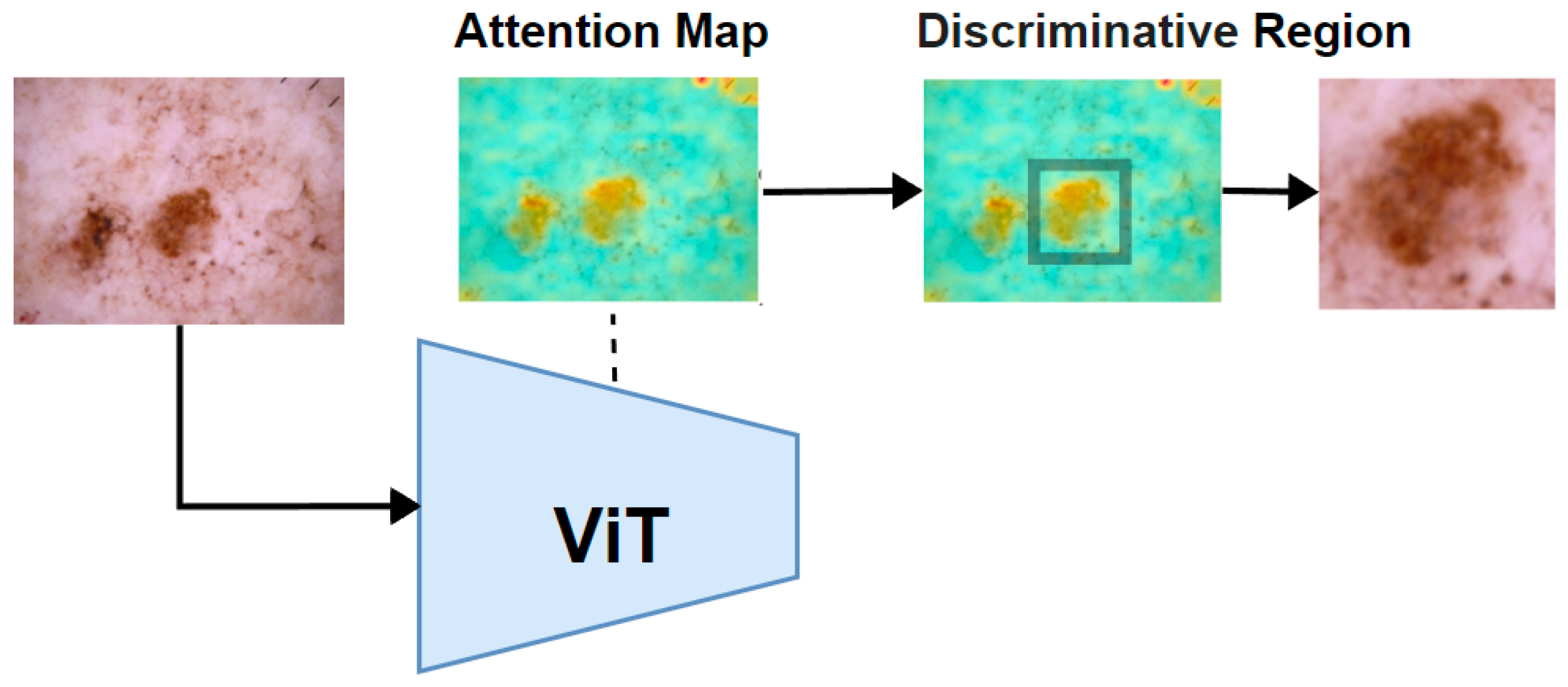 Sensors 25 02479 g005