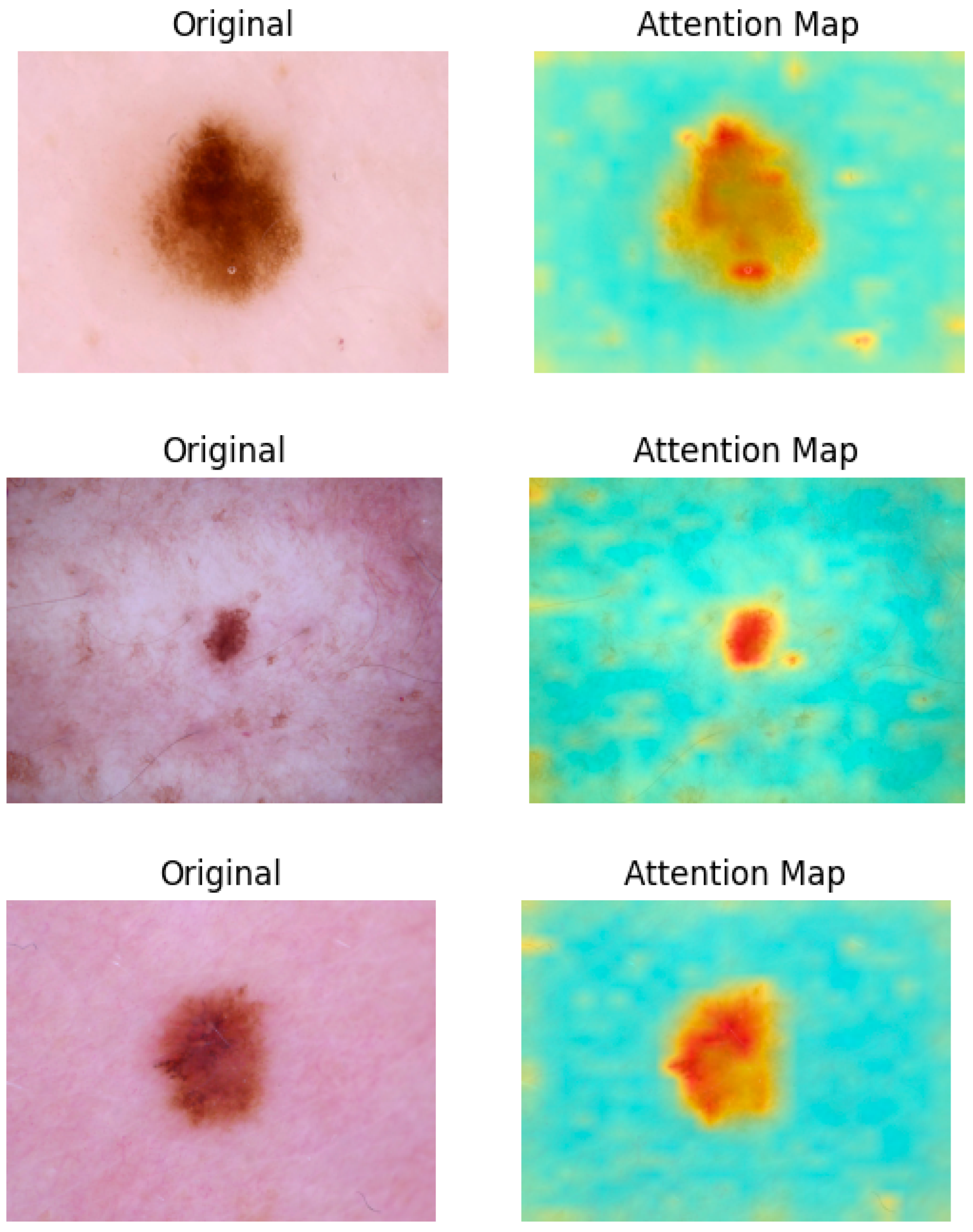 Sensors 25 02479 g008