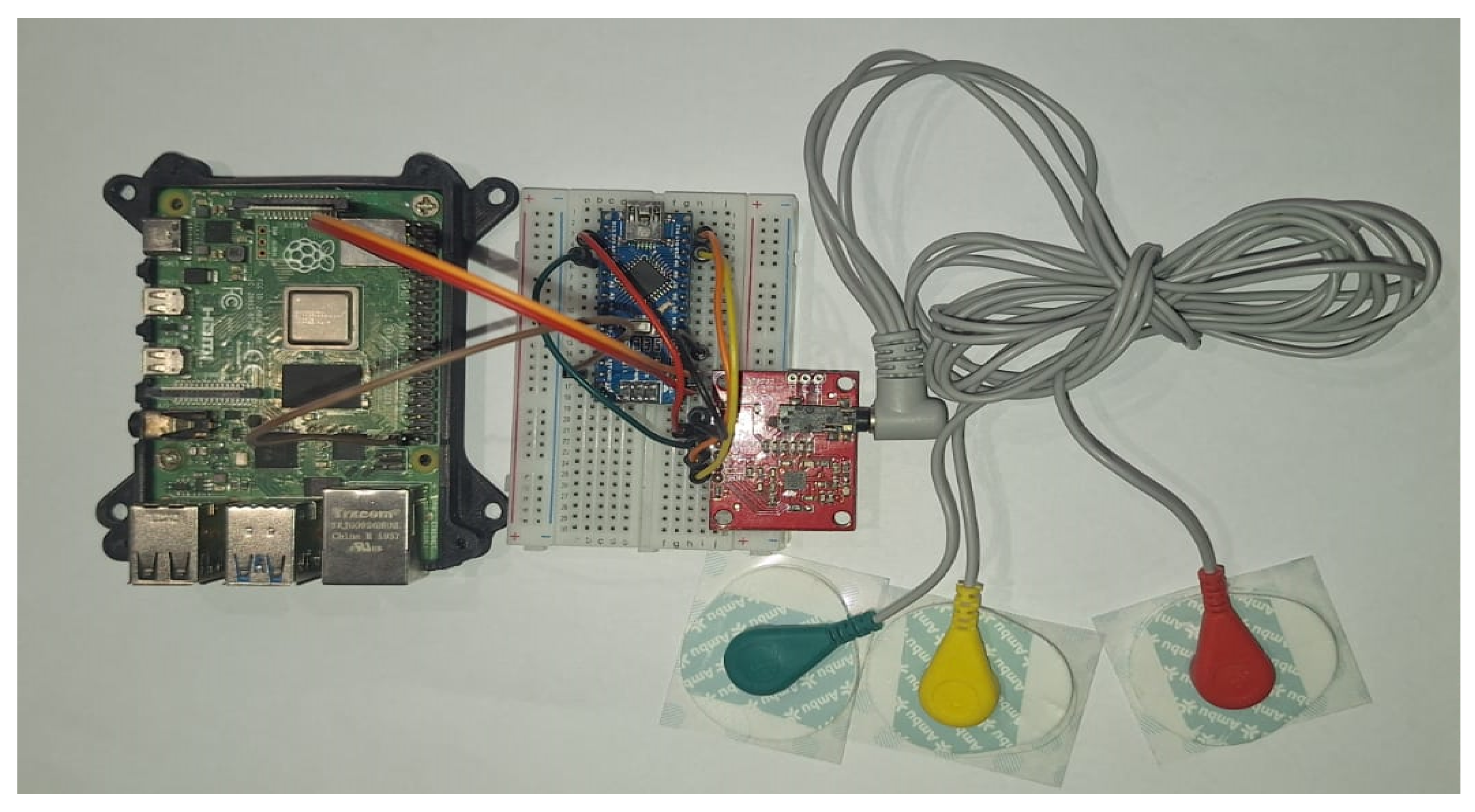 Sensors 25 02496 g014