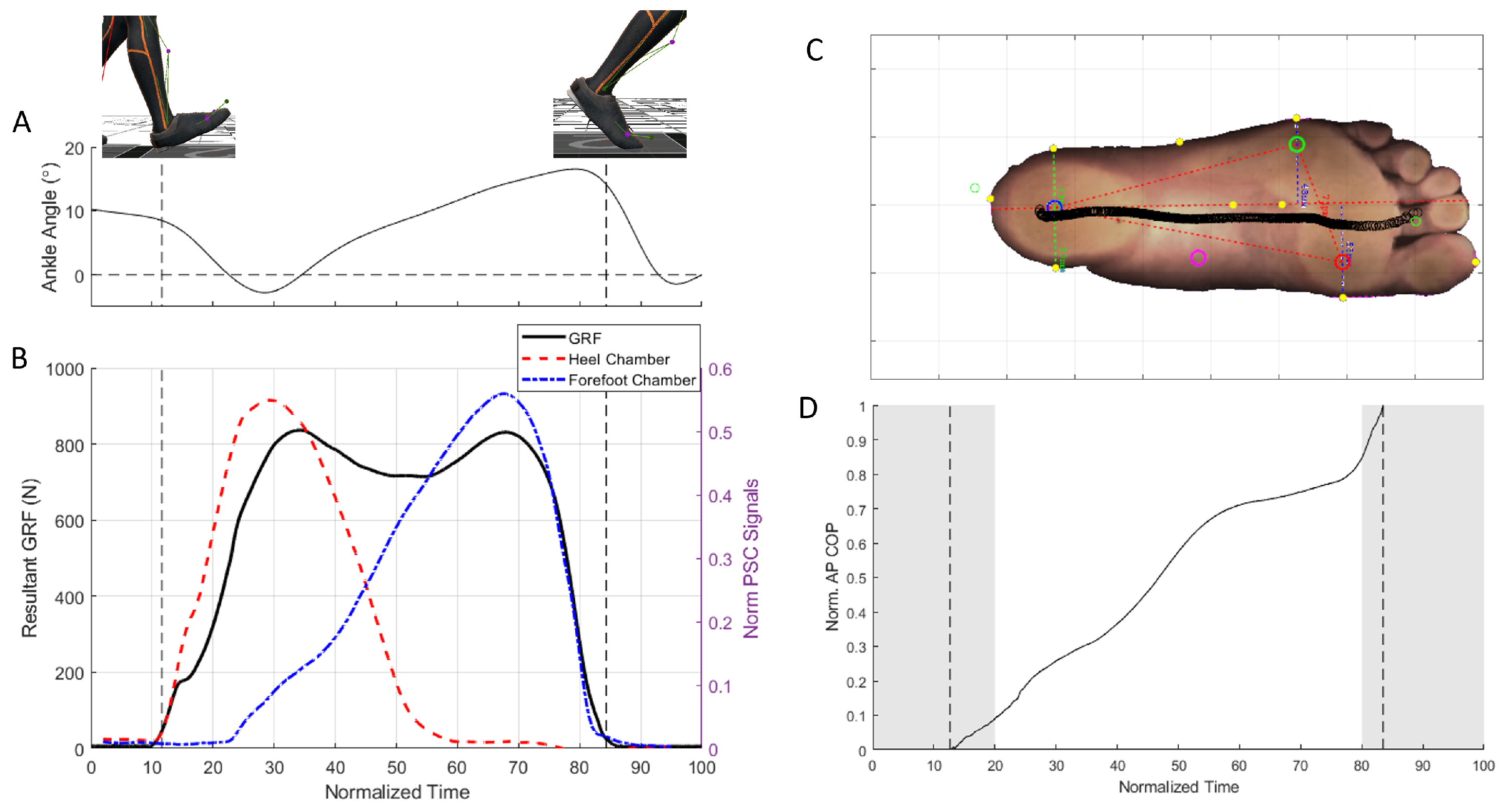 Sensors 25 02524 g004