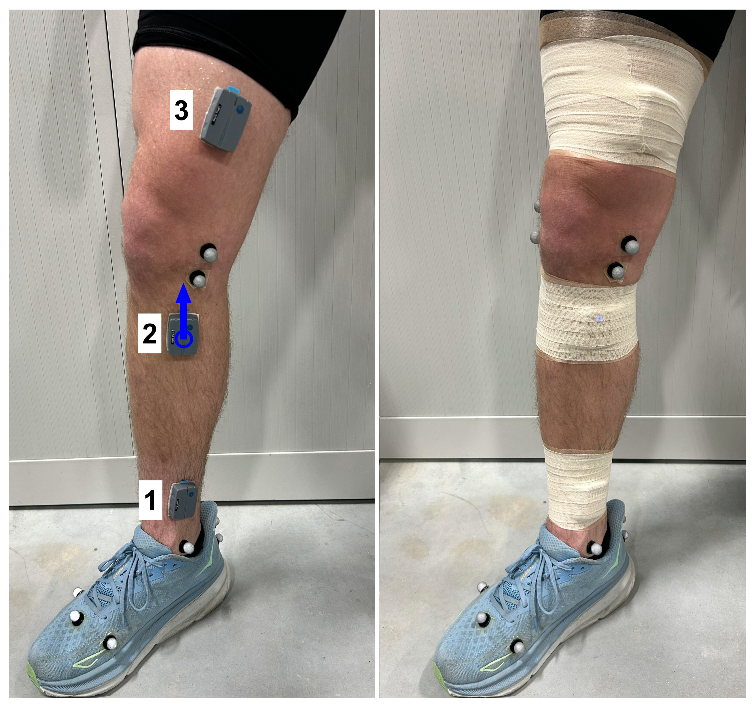 Sensors 25 02656 g002