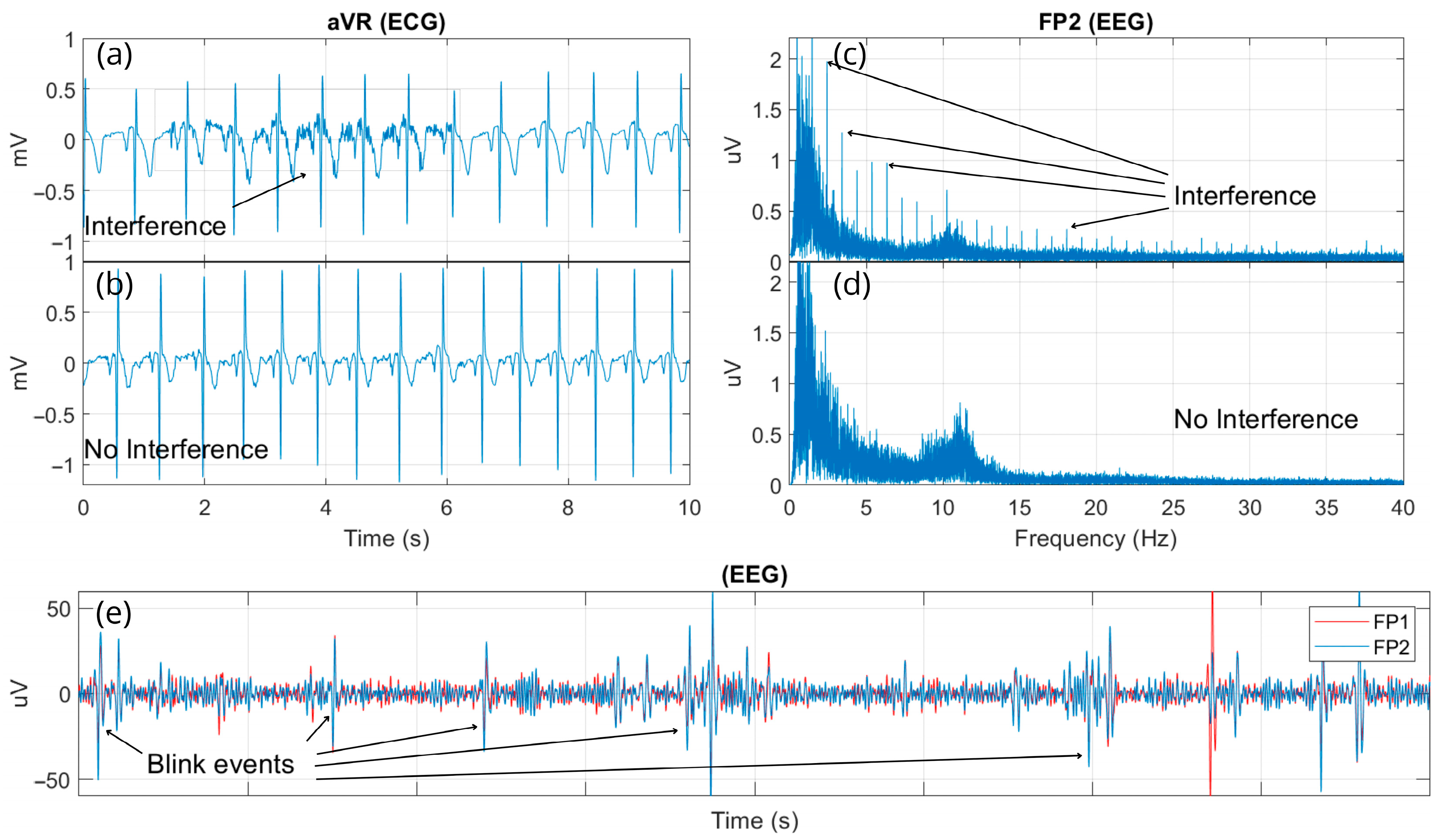 Sensors 25 02816 g011