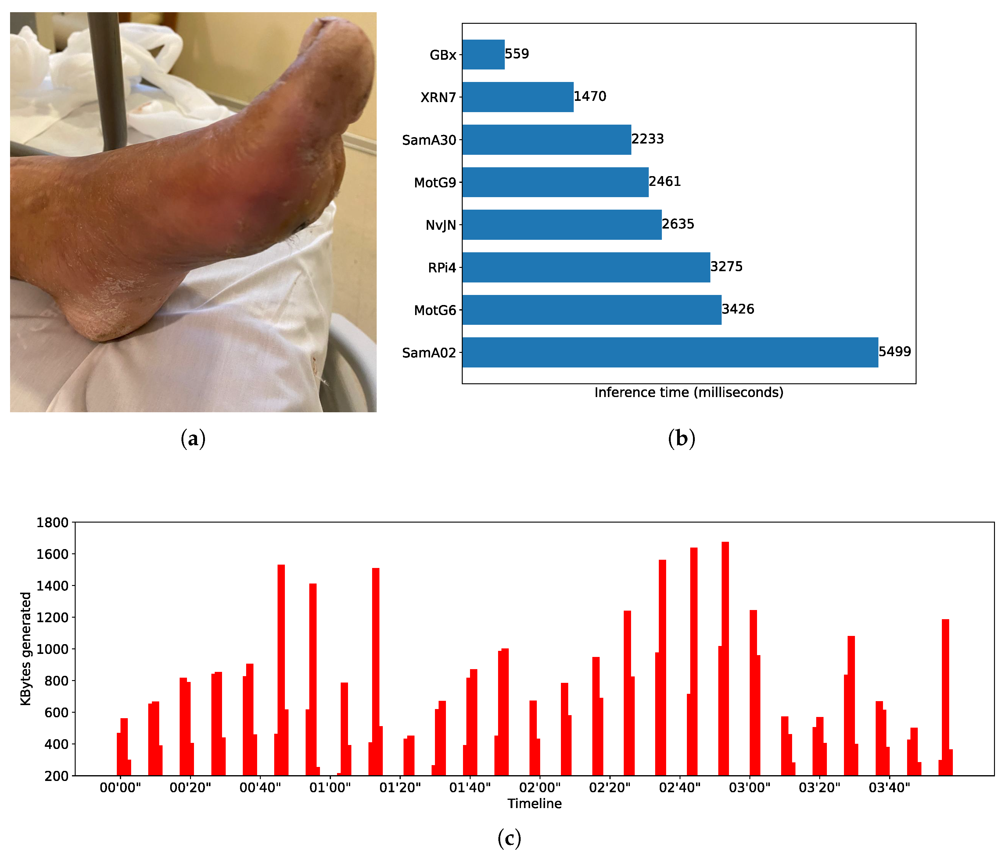 Sensors 25 02875 g004