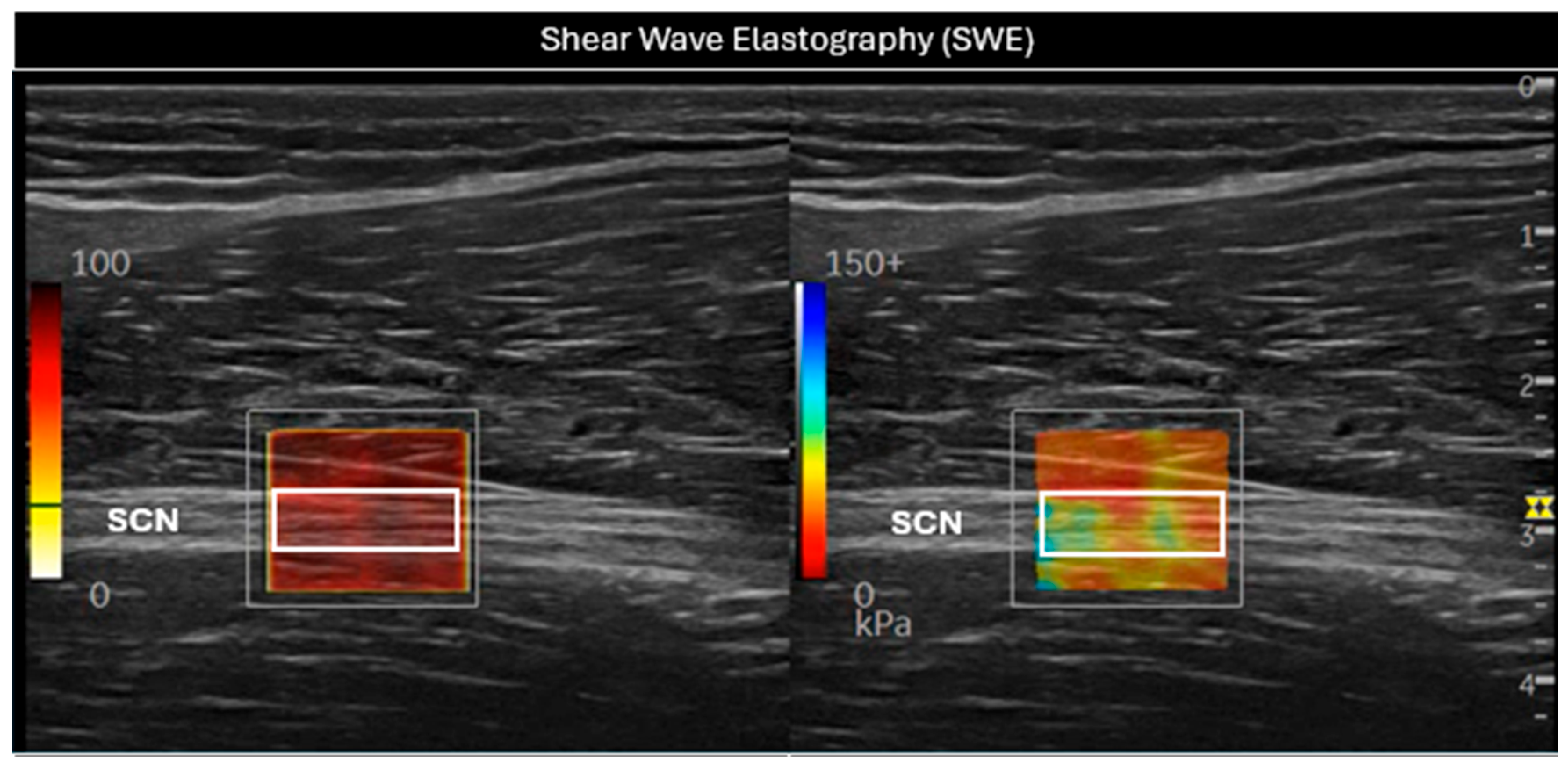 Sensors 25 02885 g002
