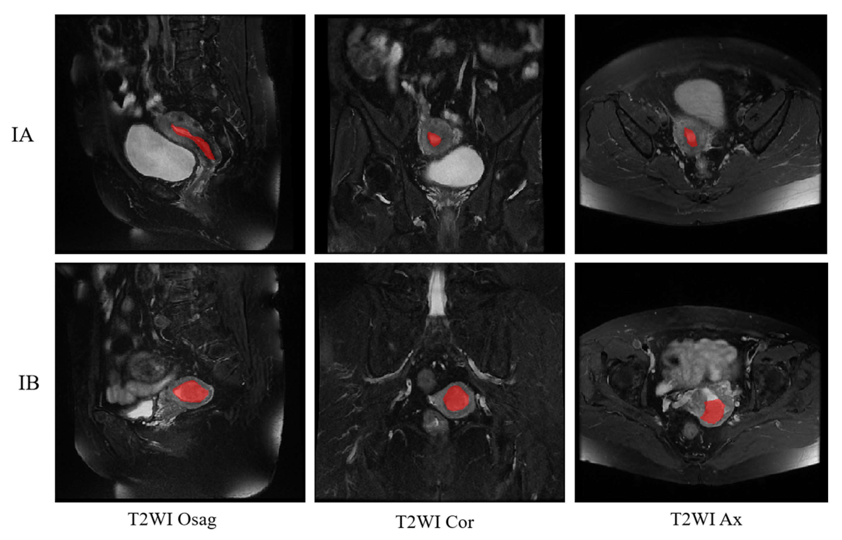 Sensors 25 02932 g010