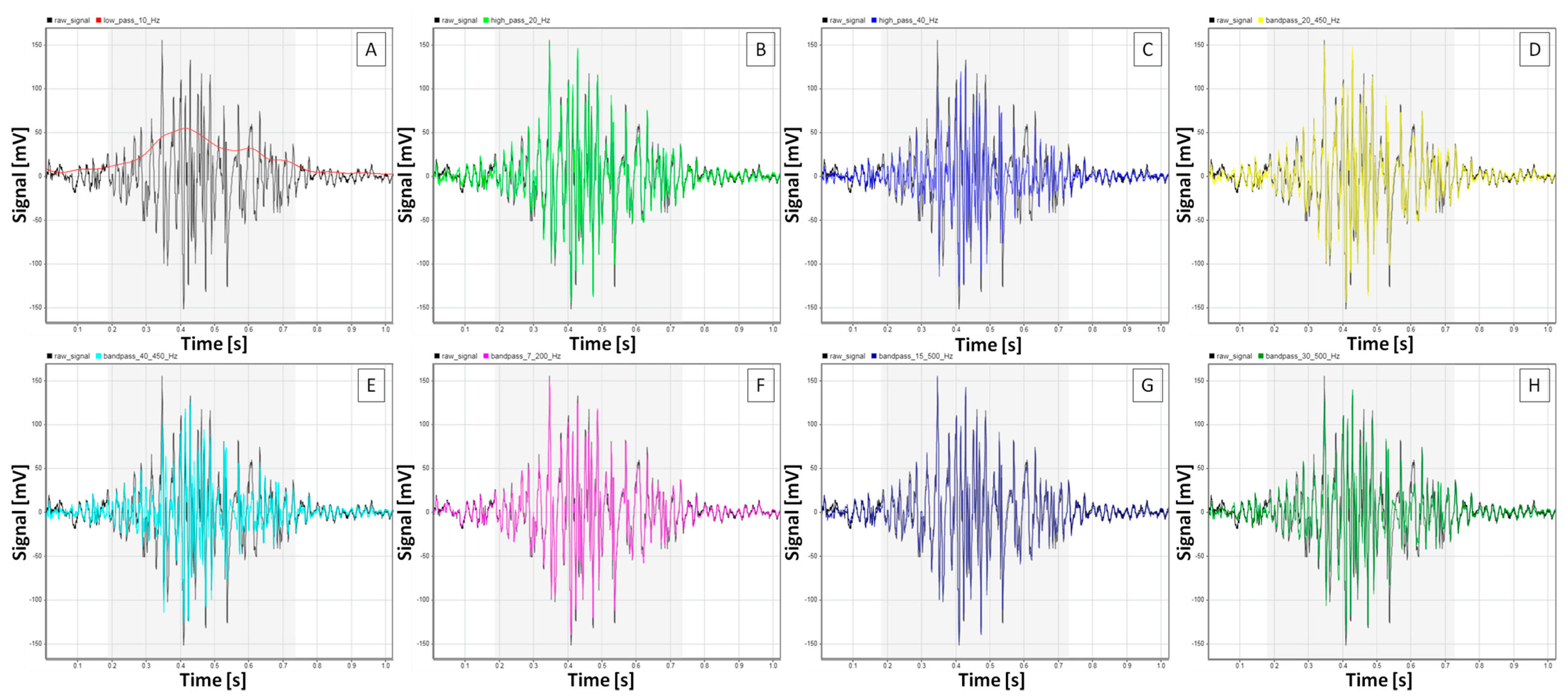 Sensors 25 02962 g003