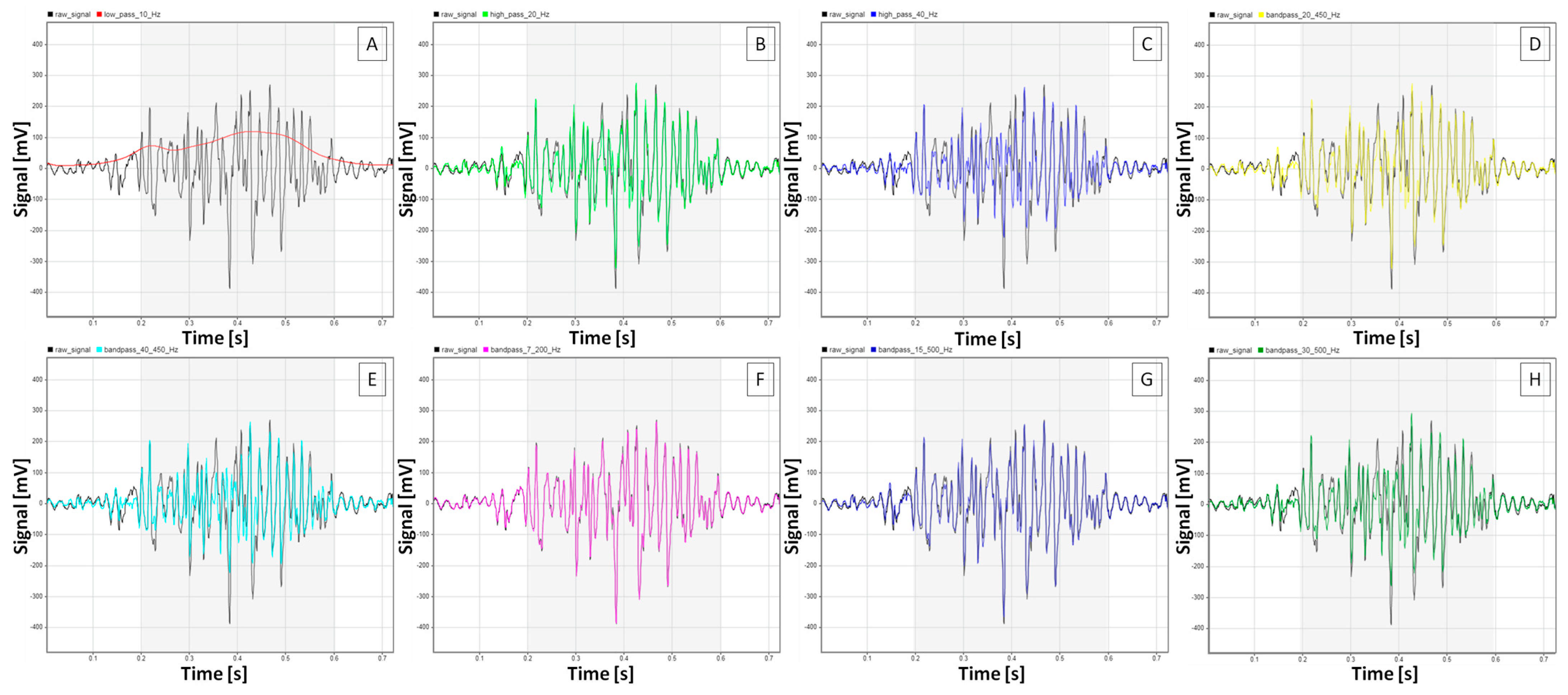 Sensors 25 02962 g004