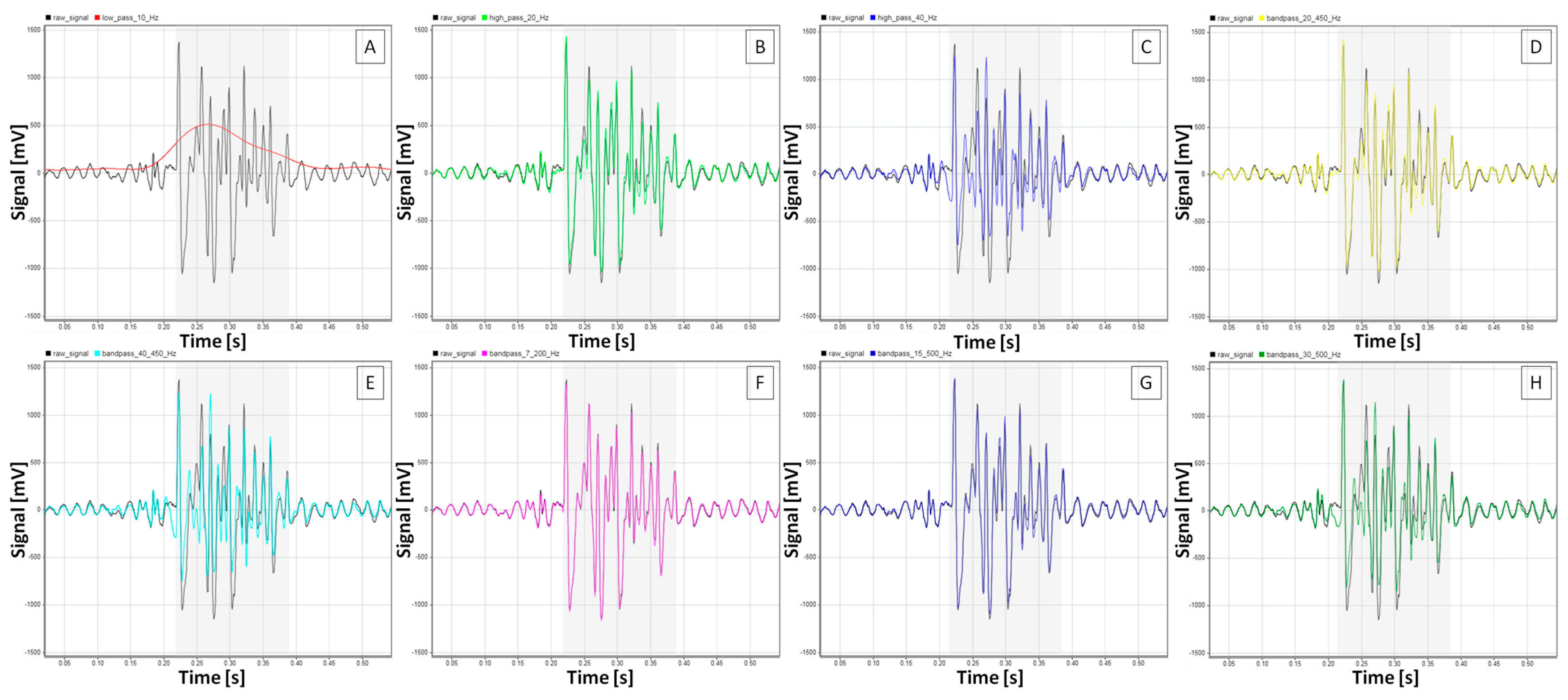 Sensors 25 02962 g005