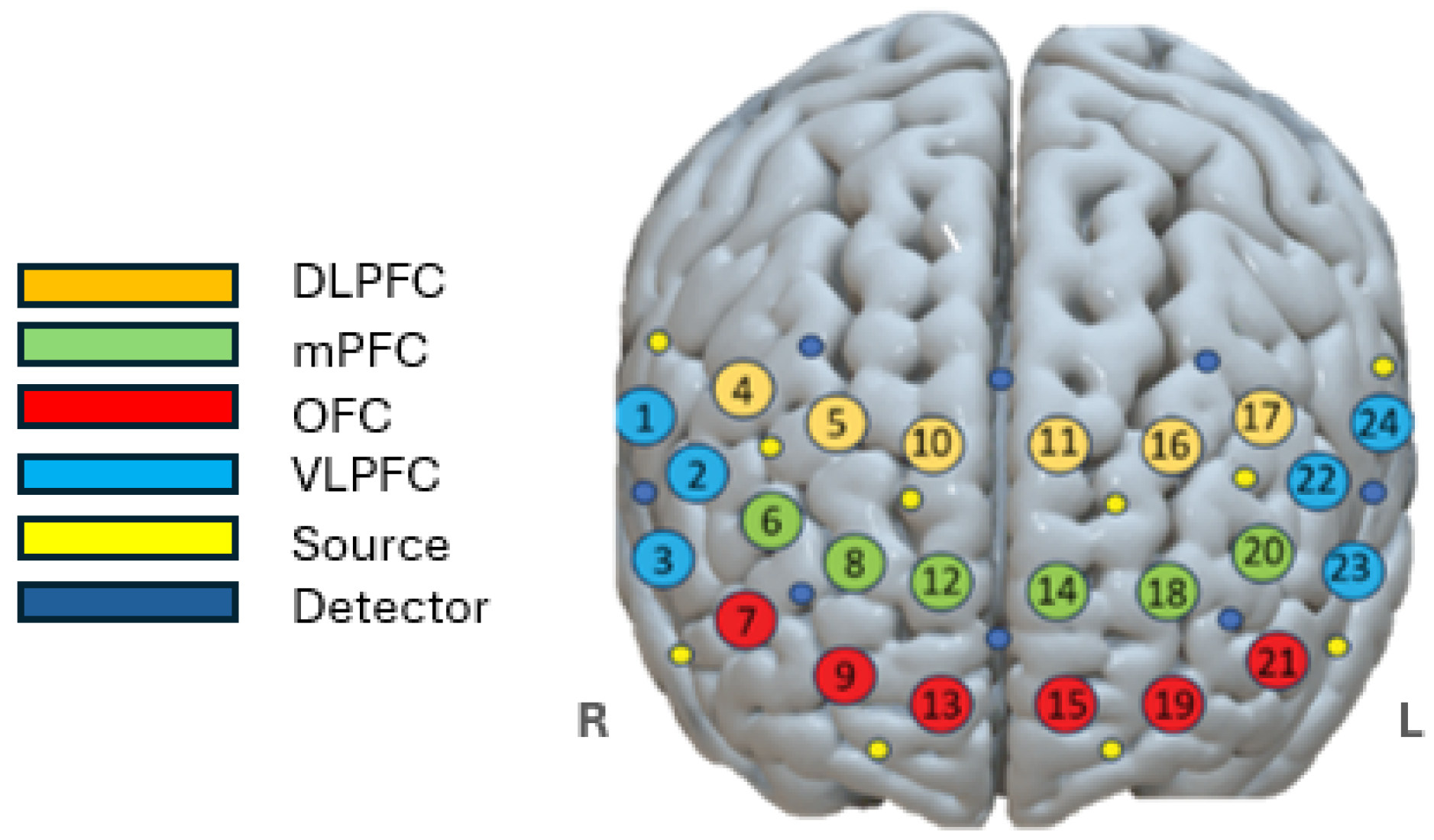 Sensors 25 02965 g006