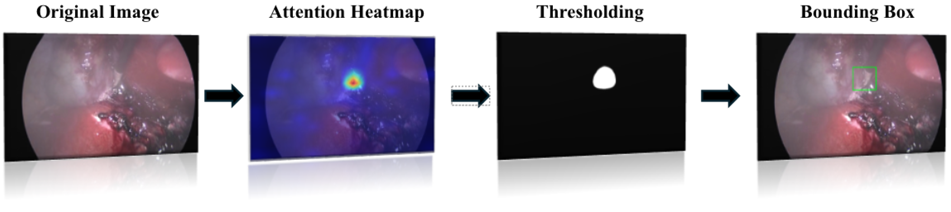 Sensors 25 03017 g005