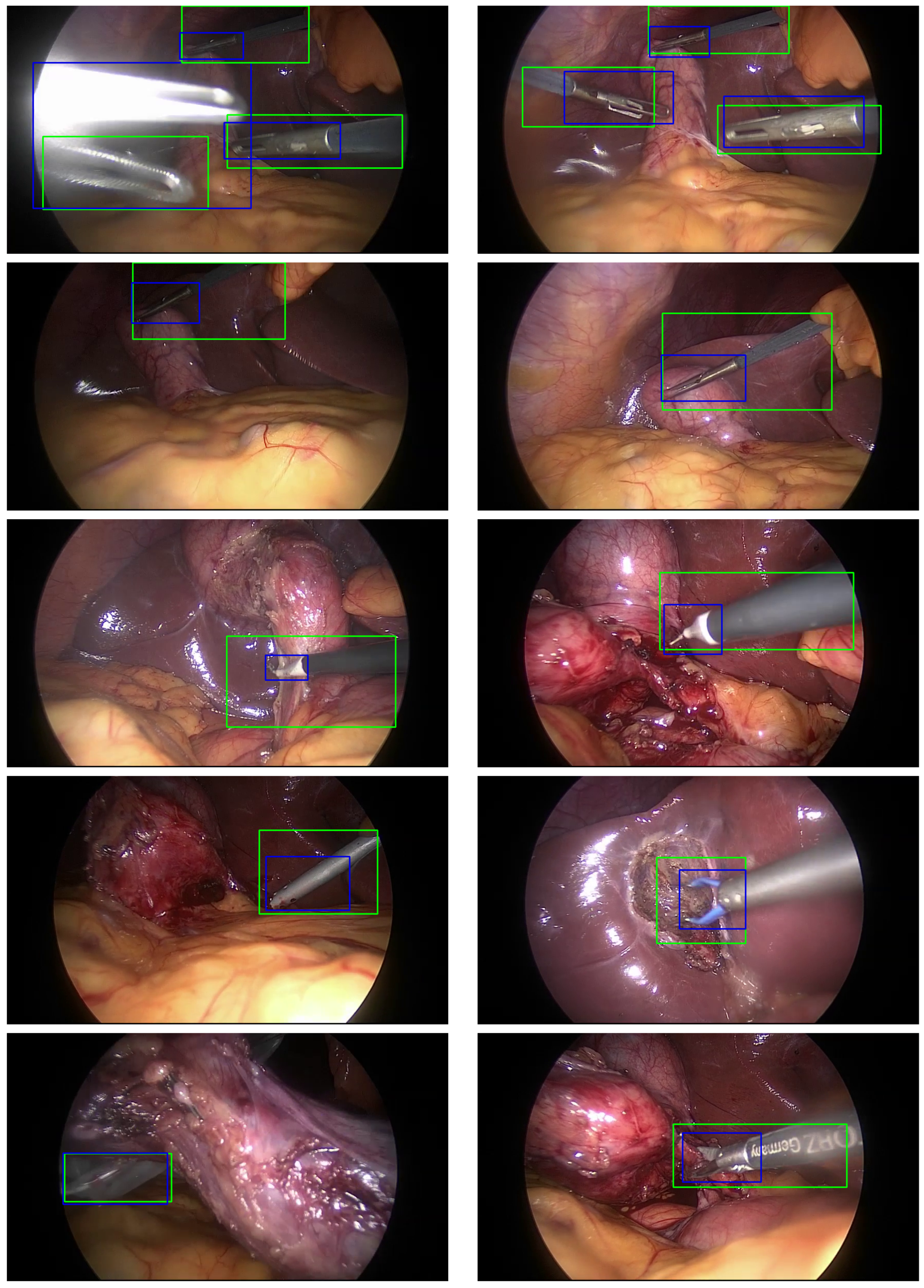 Sensors 25 03017 g006