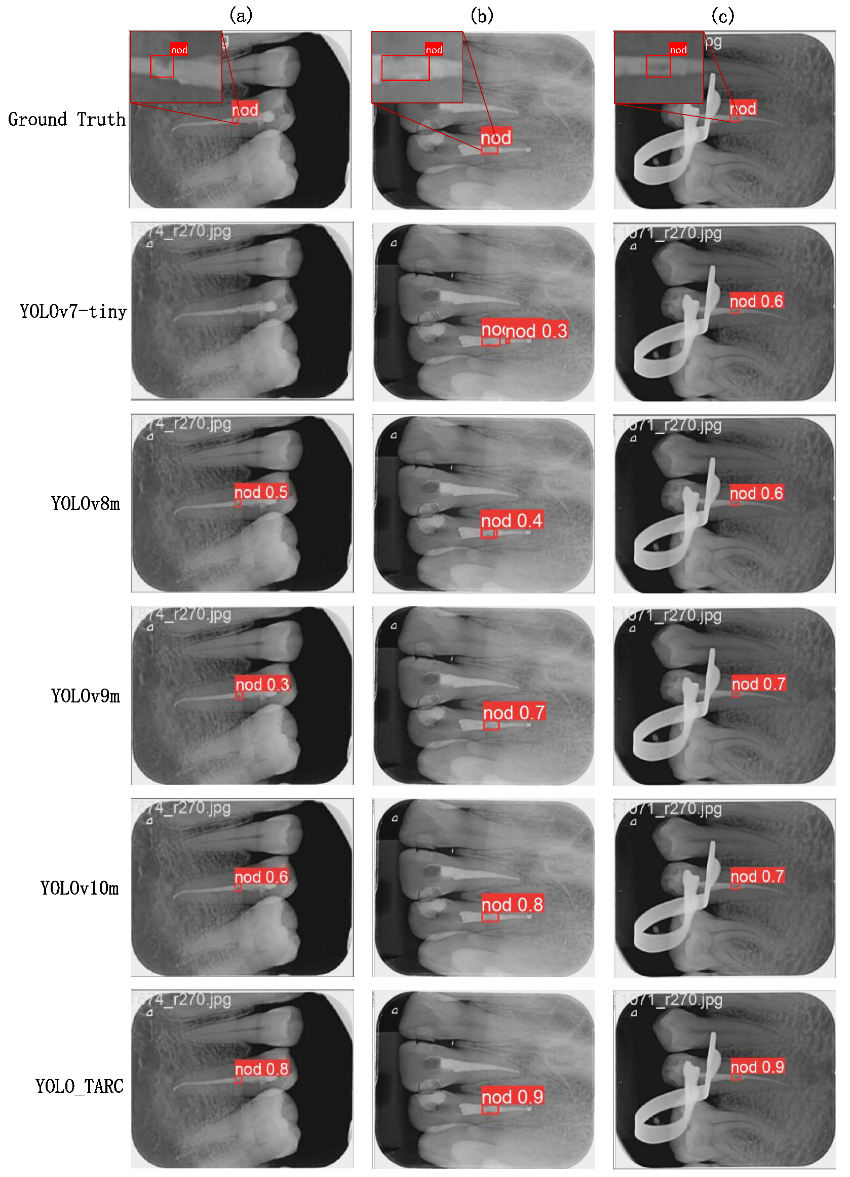 Sensors 25 03036 g005