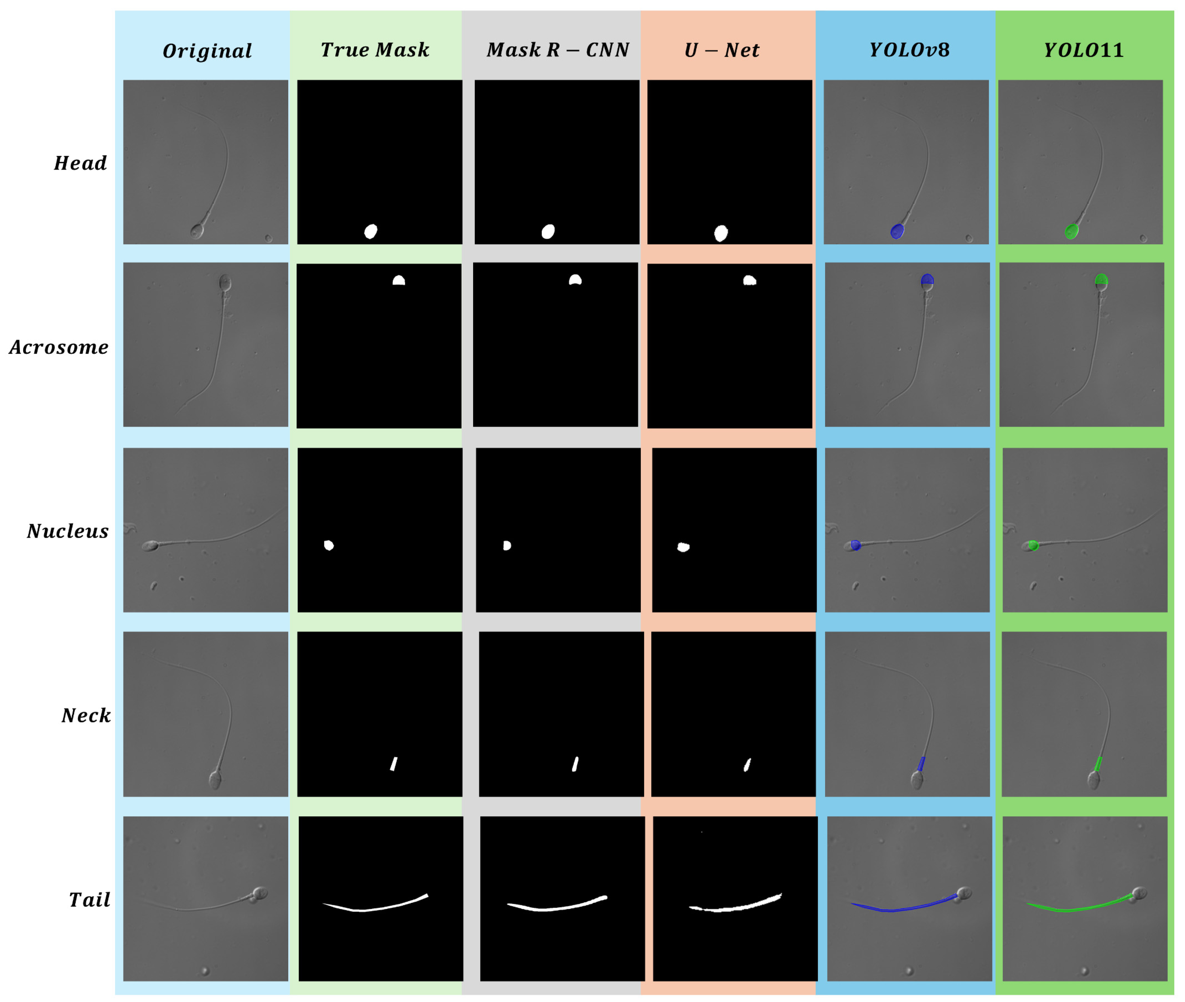 Sensors 25 03093 g010