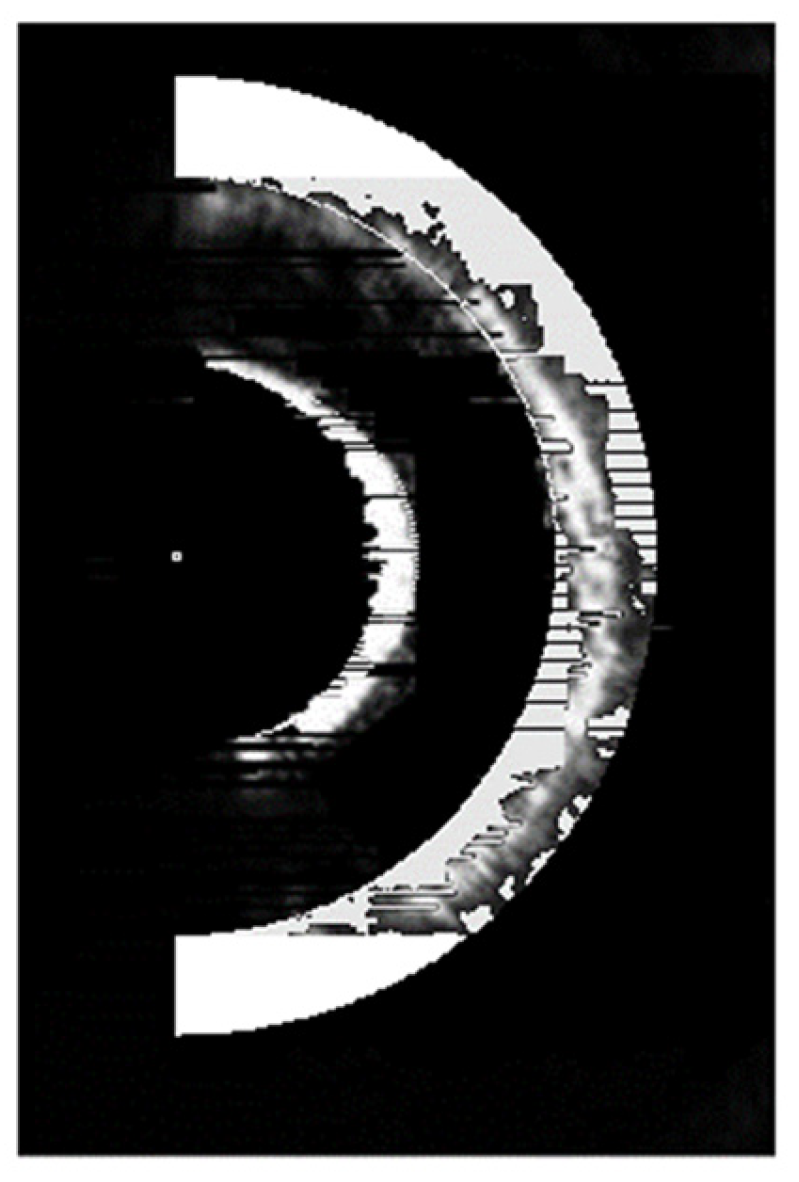 Sensors 25 03221 g017