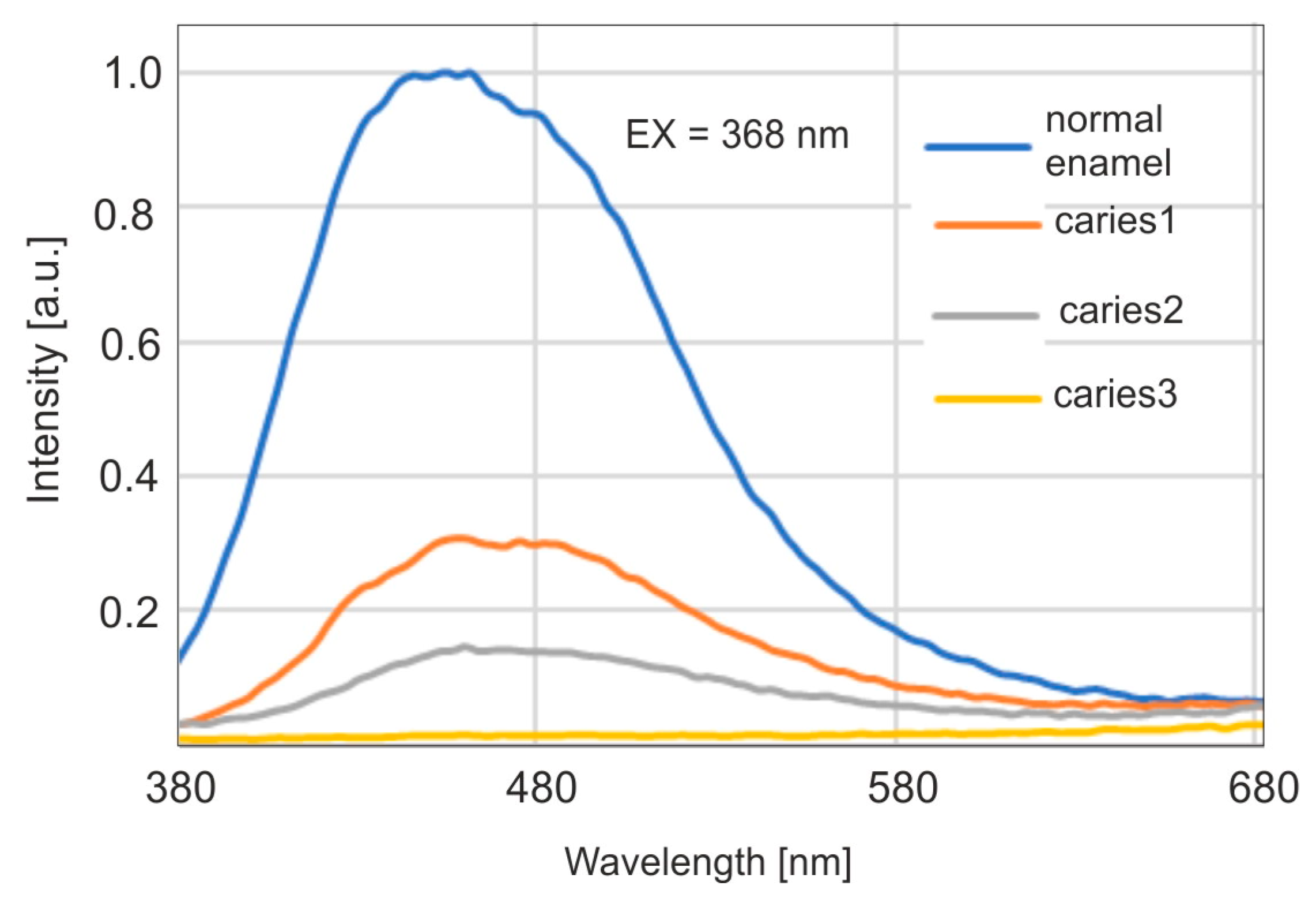 Sensors 25 03253 g005