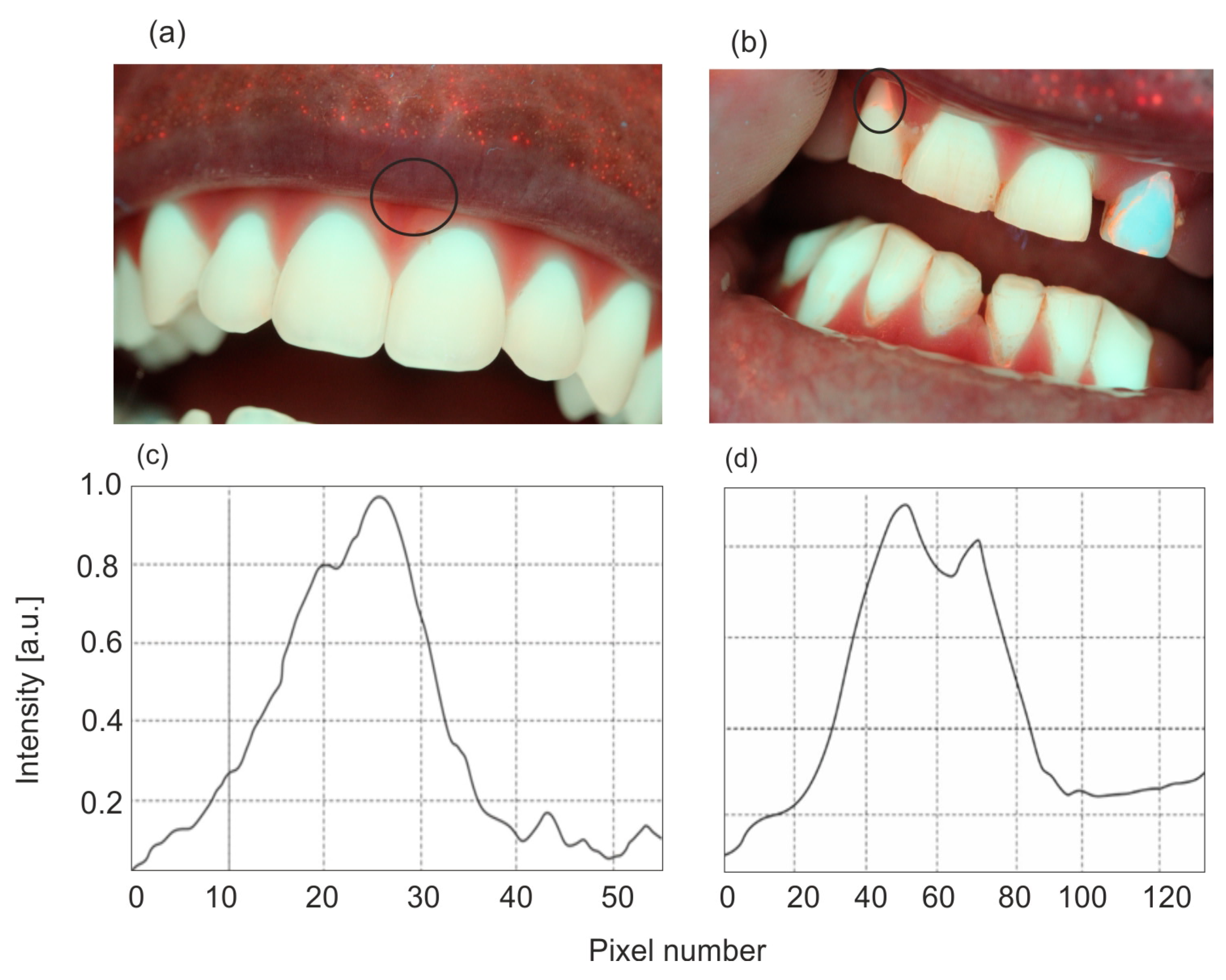 Sensors 25 03253 g008