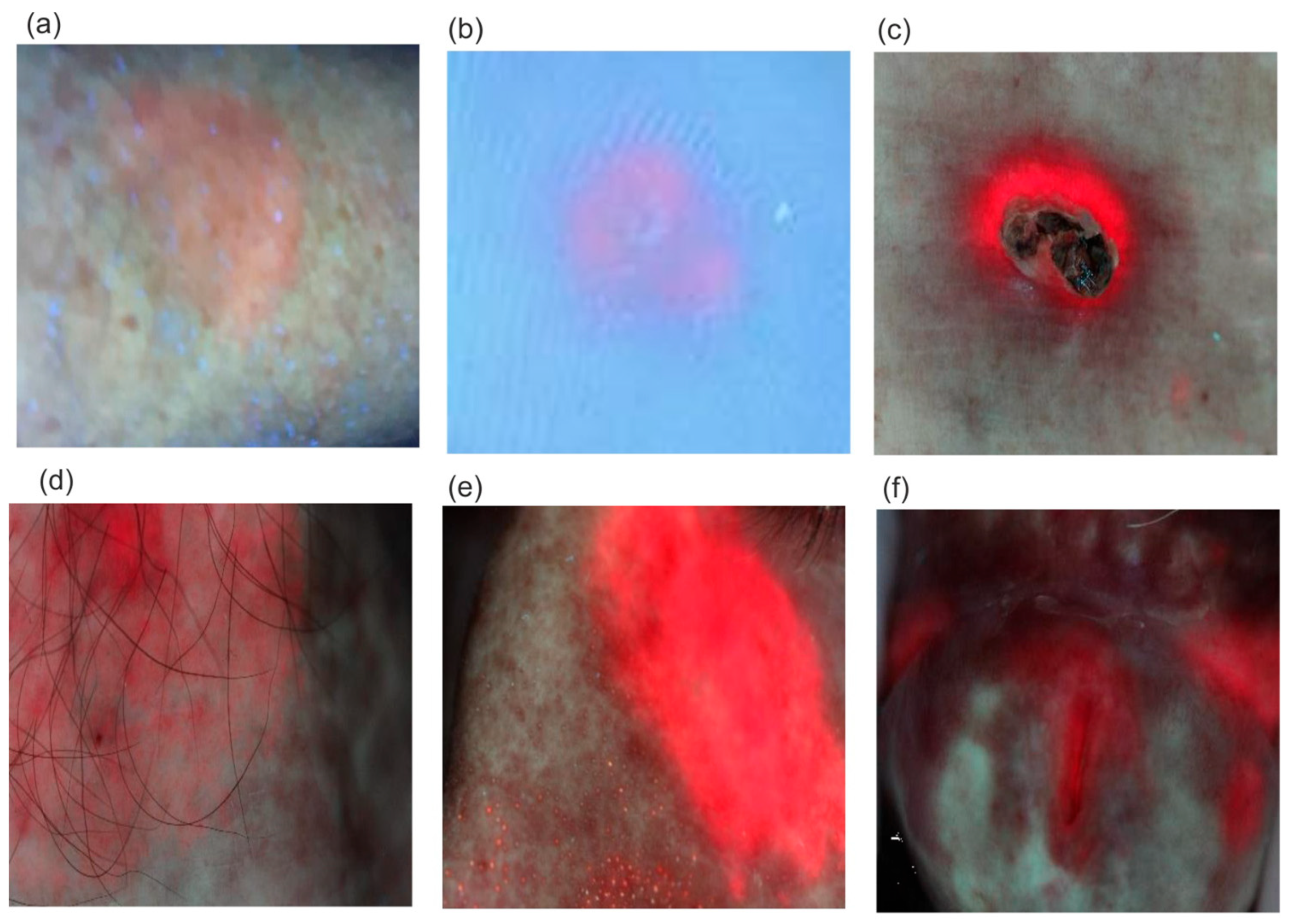 Sensors 25 03253 g014