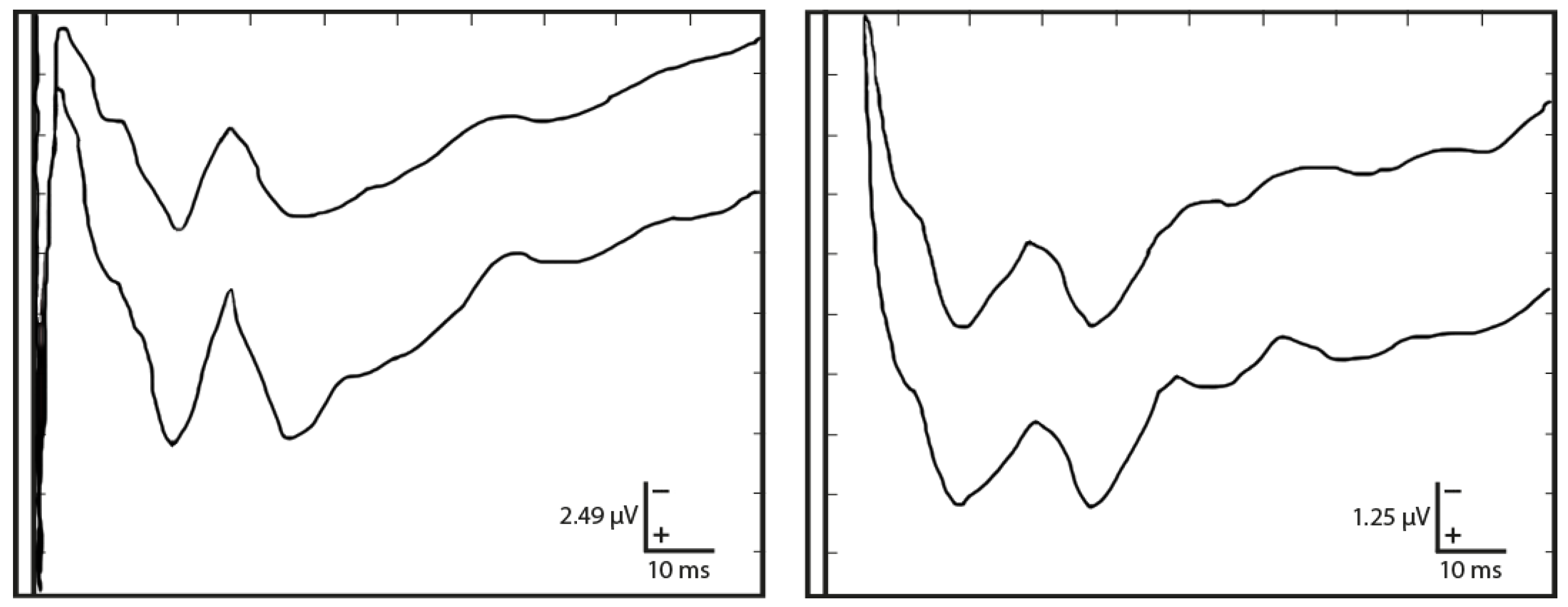Sensors 25 03355 g002