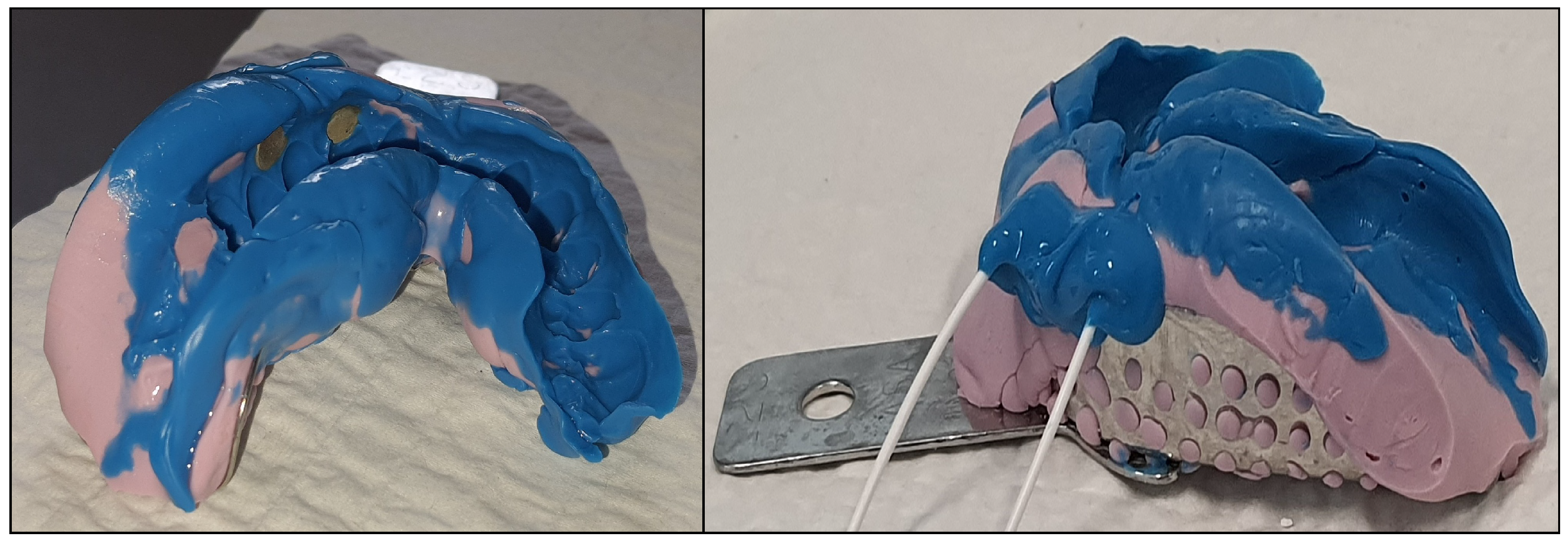 Sensors 25 03355 g005