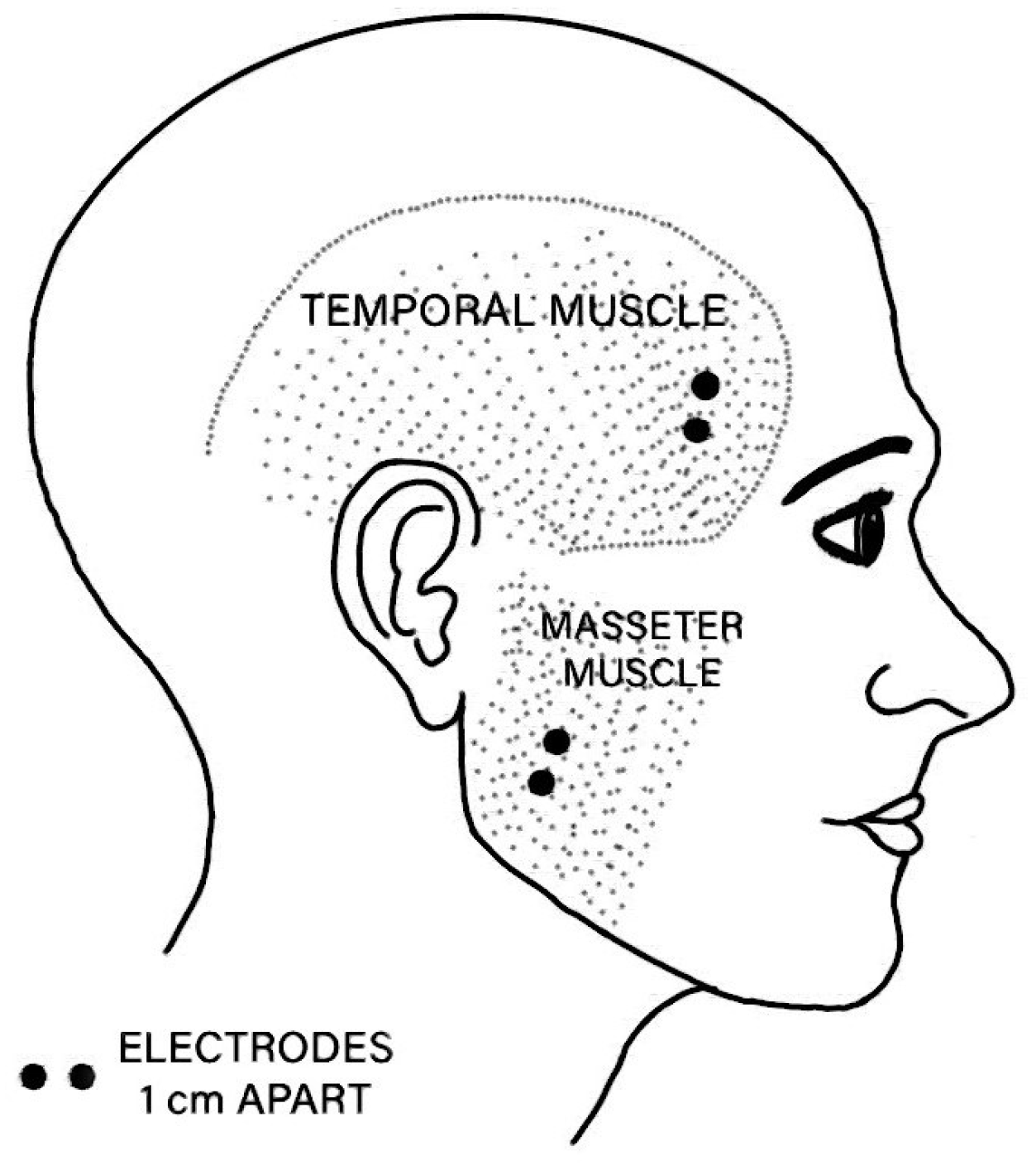 Sensors 25 03355 g006